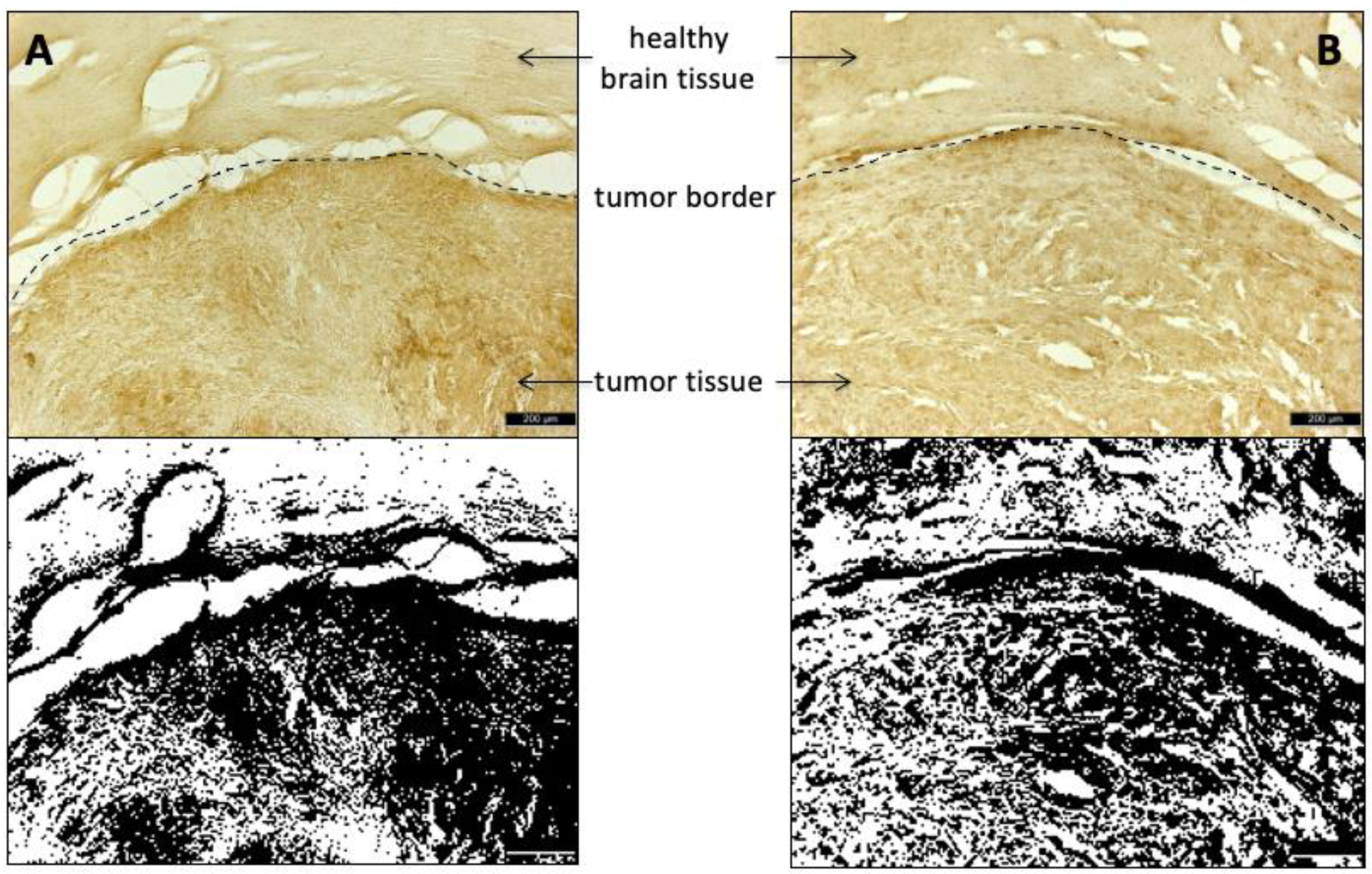 Cancers 13 06030 g010