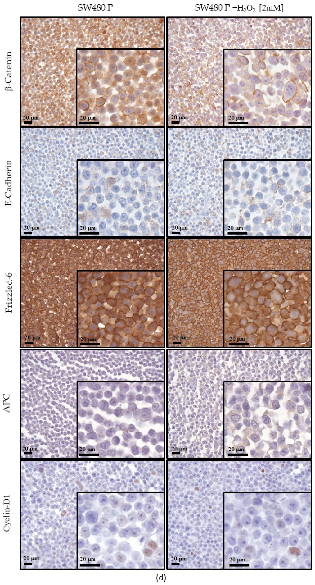 Cancers 13 06045 g007d