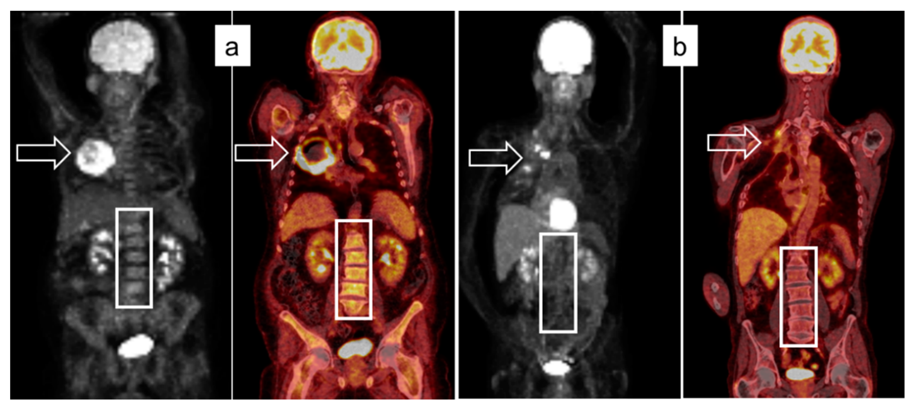 Cancers 13 06096 g004