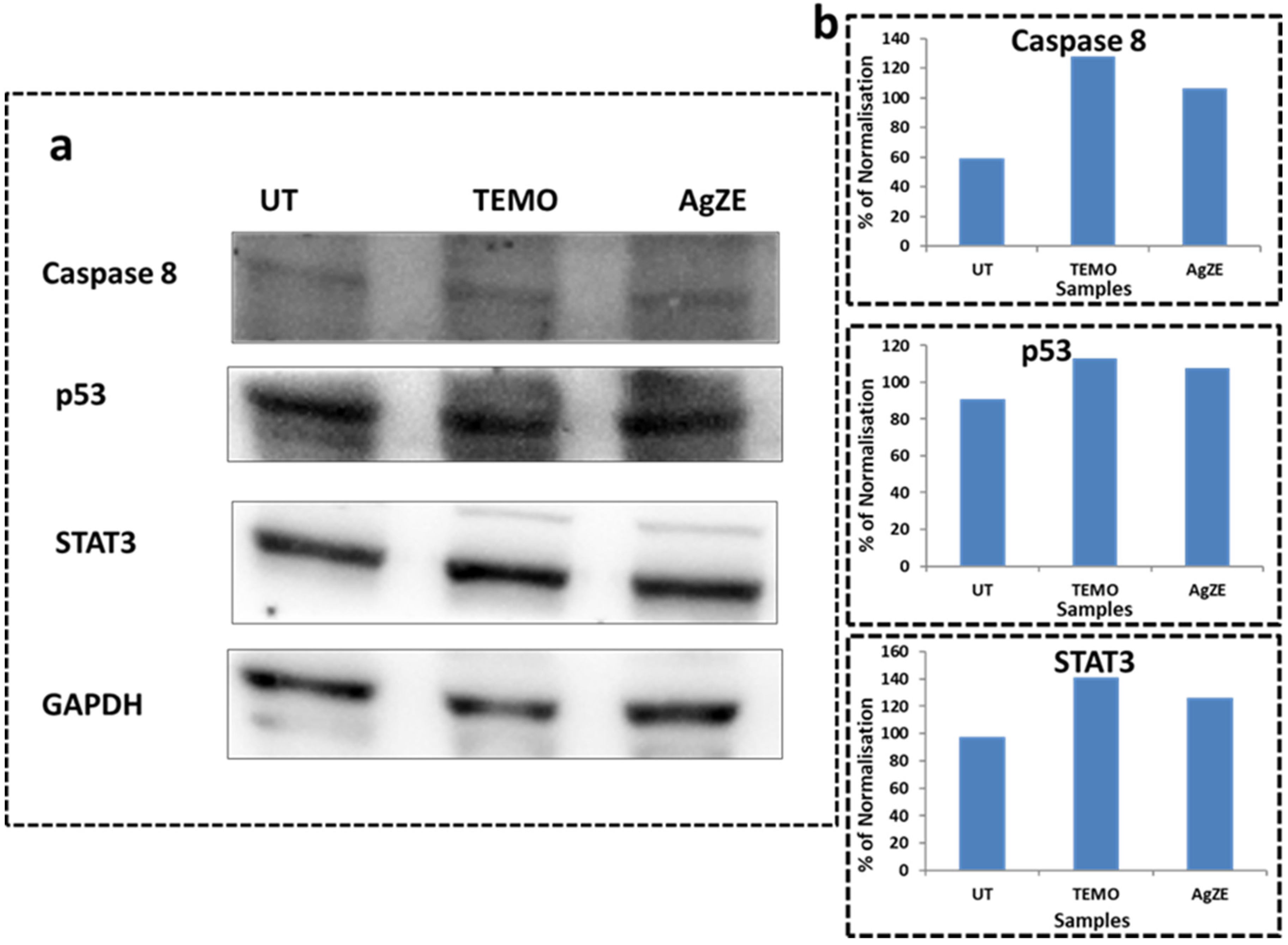 Cancers 13 06114 g007