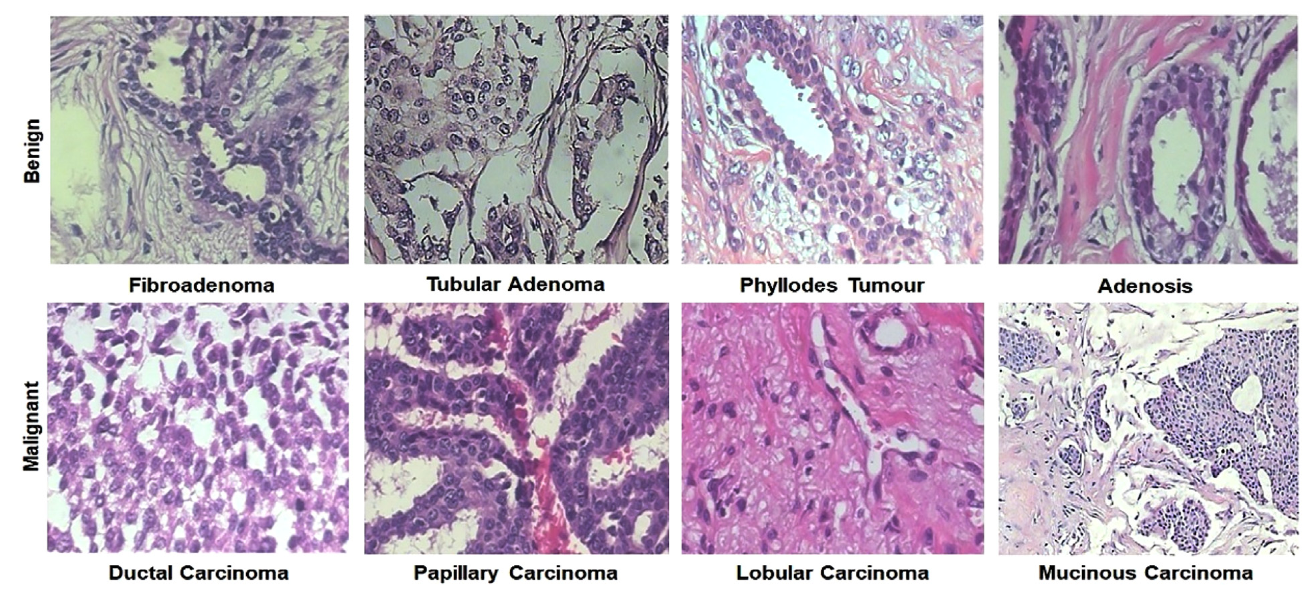 Cancers 13 06116 g009