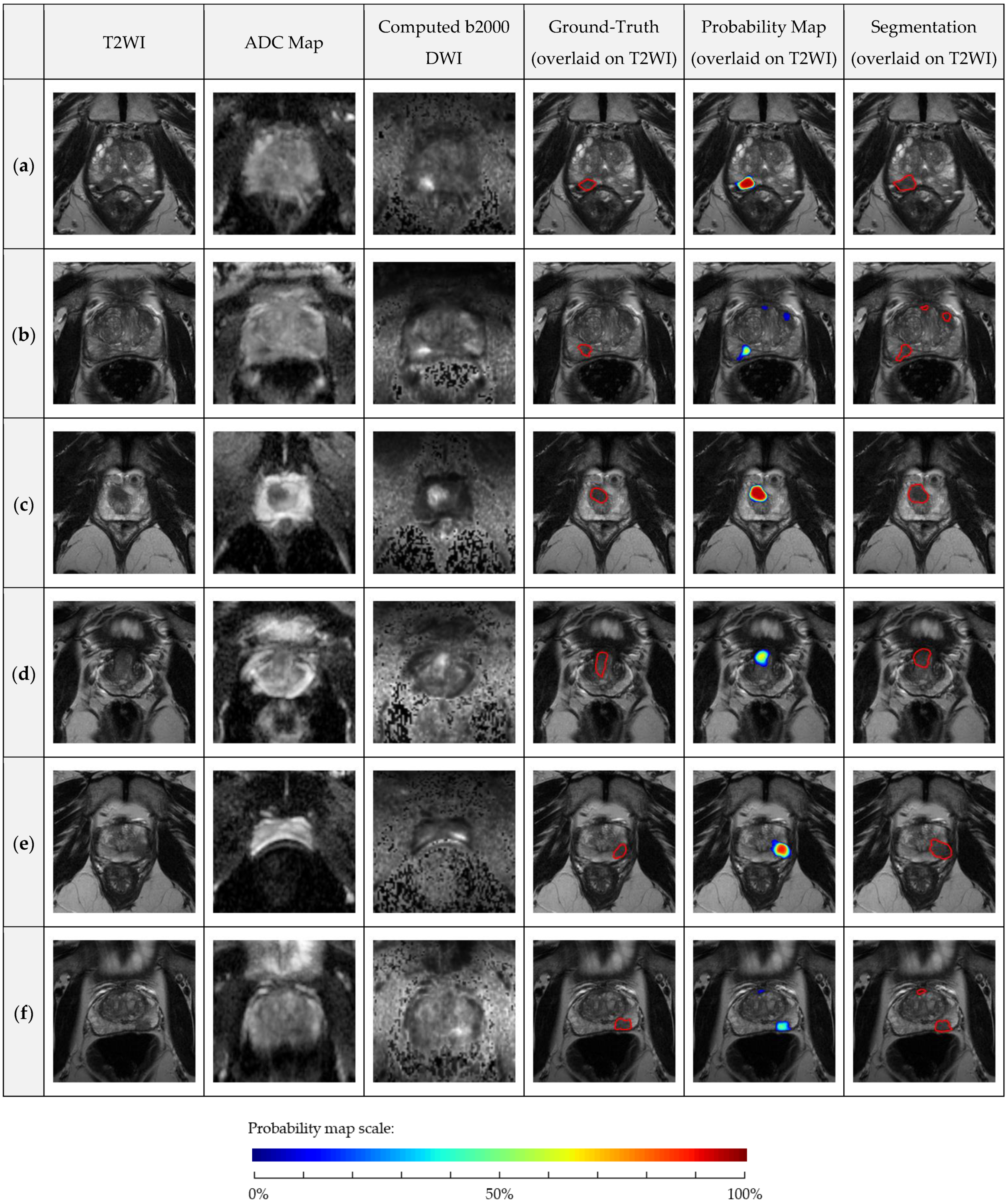 Cancers 13 06138 g005