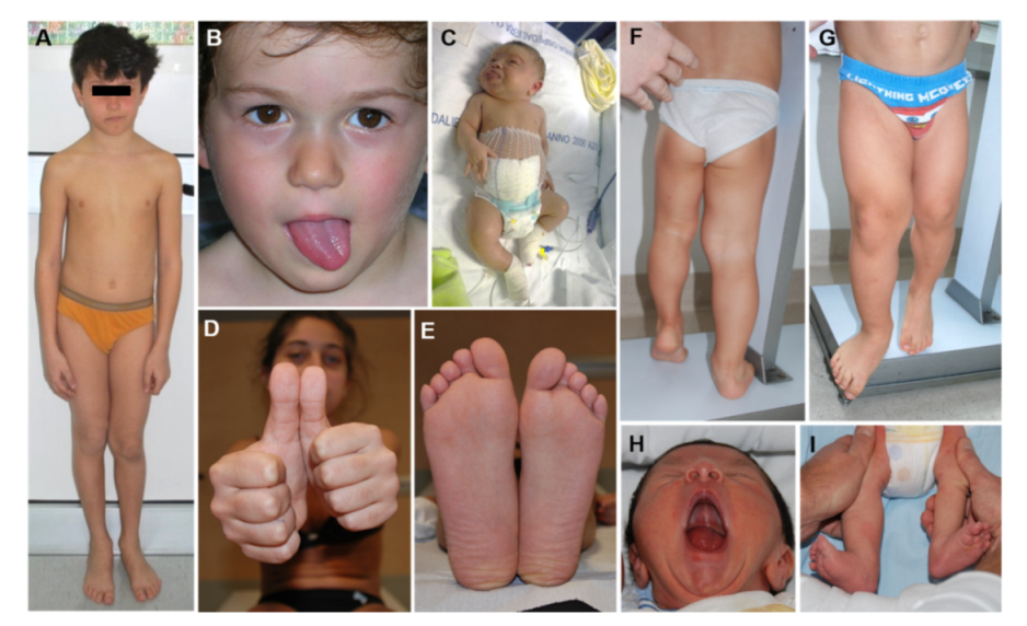 Cancers 13 06166 g003