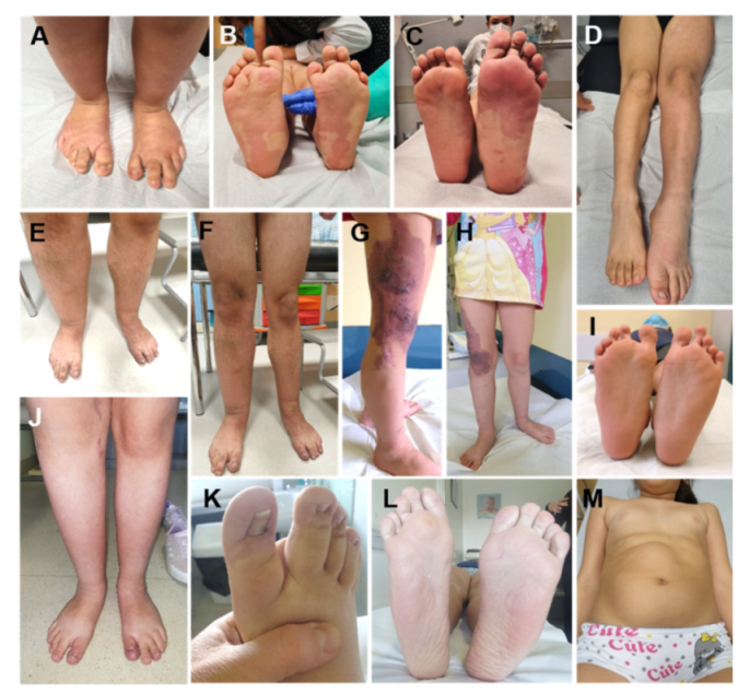 Cancers 13 06166 g004