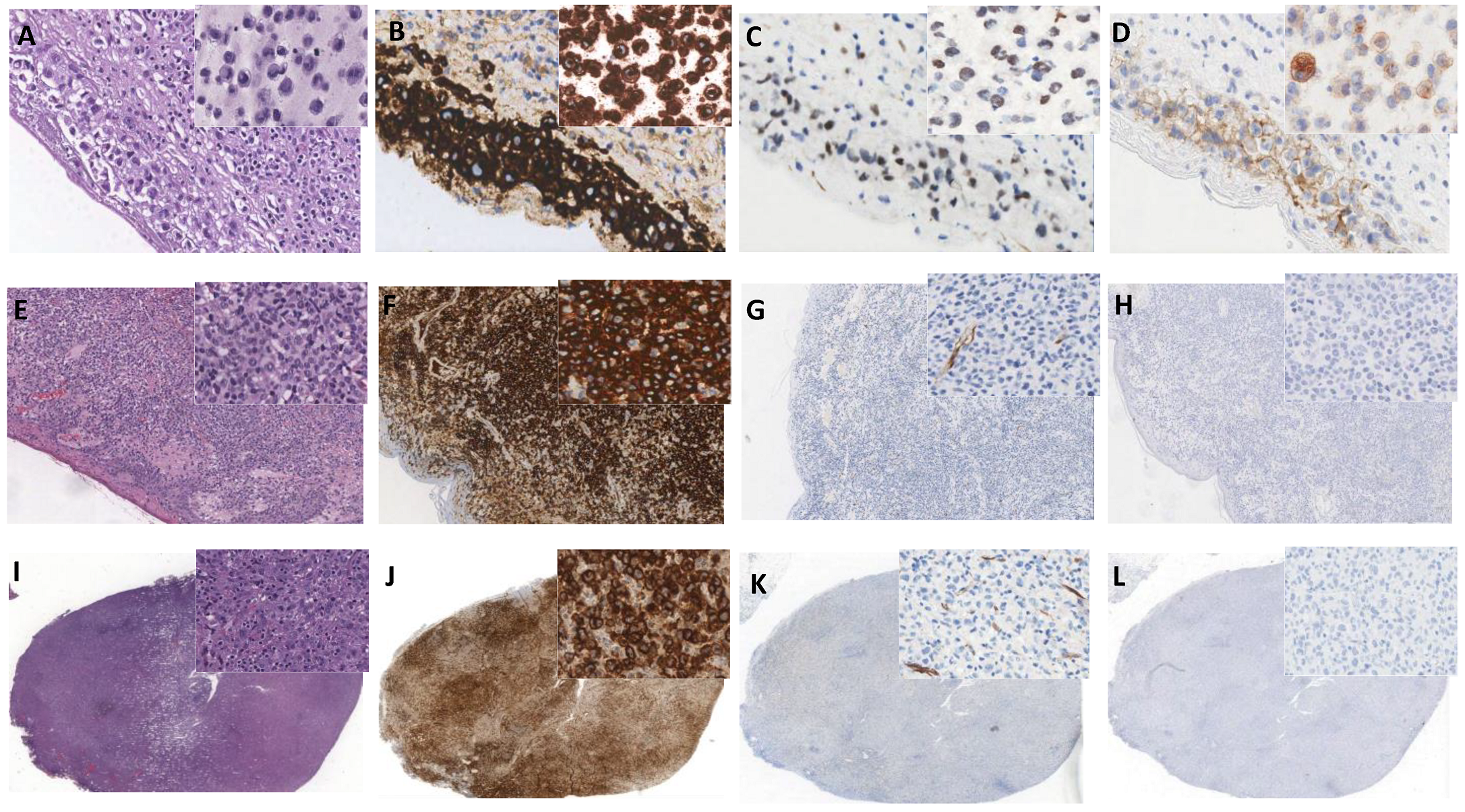 Cancers 13 06174 g005