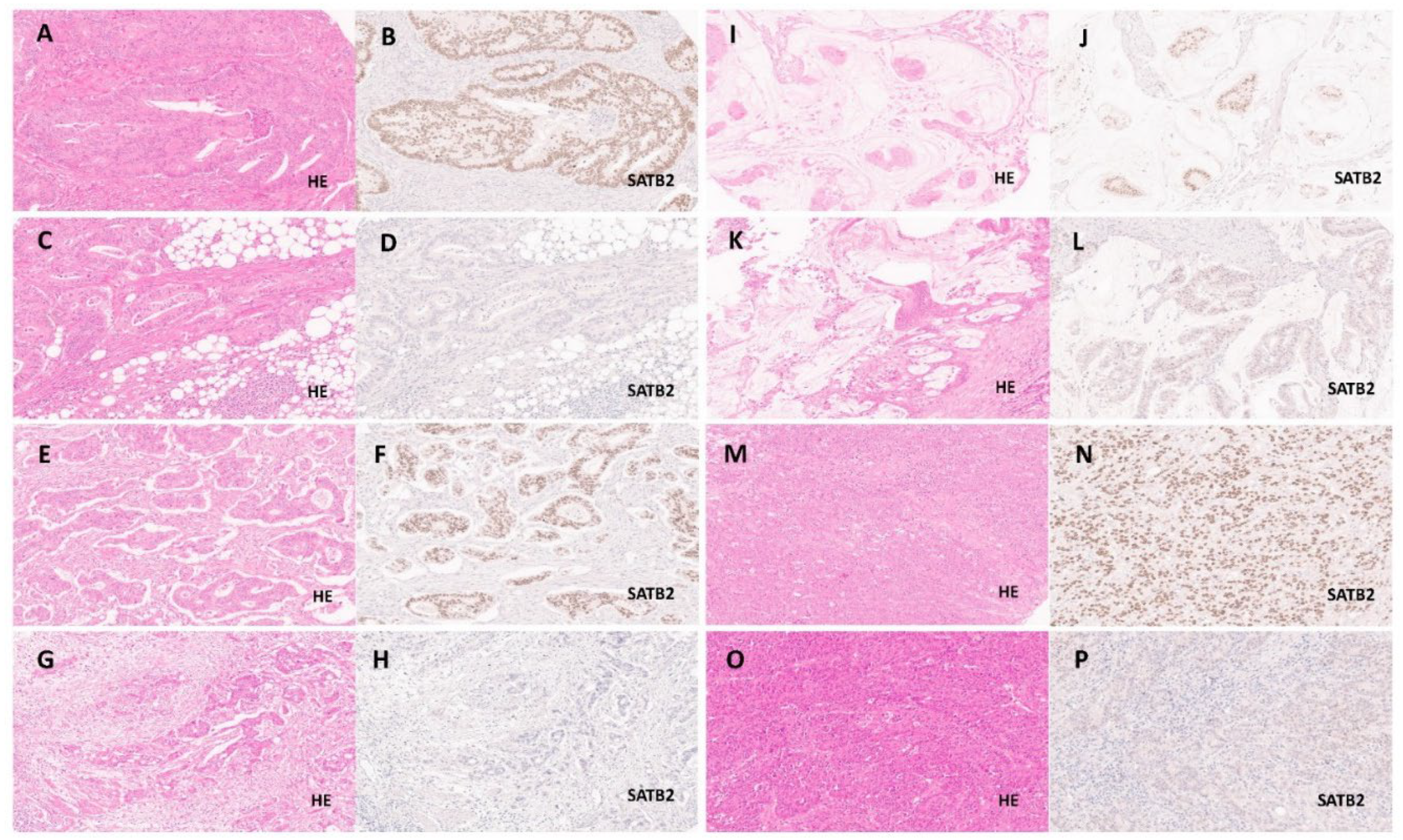 Cancers 13 06177 g001