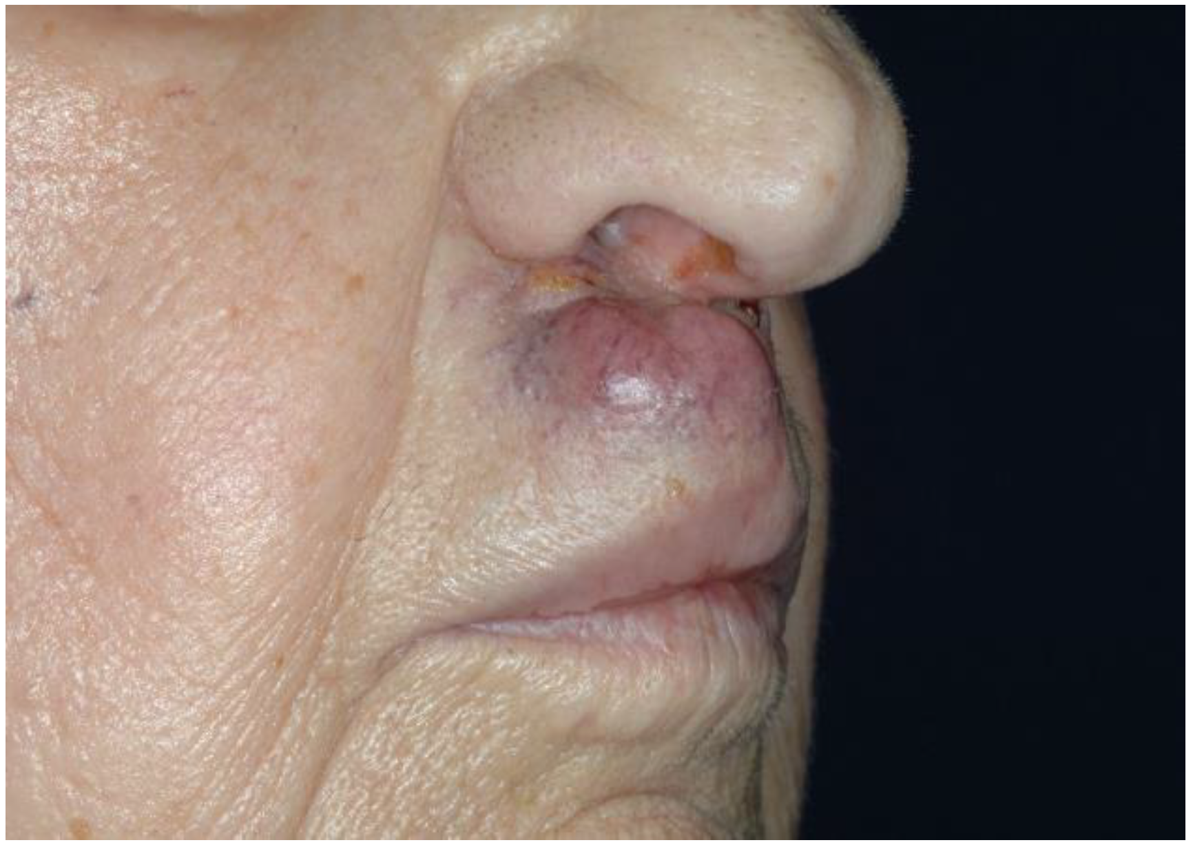 Cancers 13 06201 g001