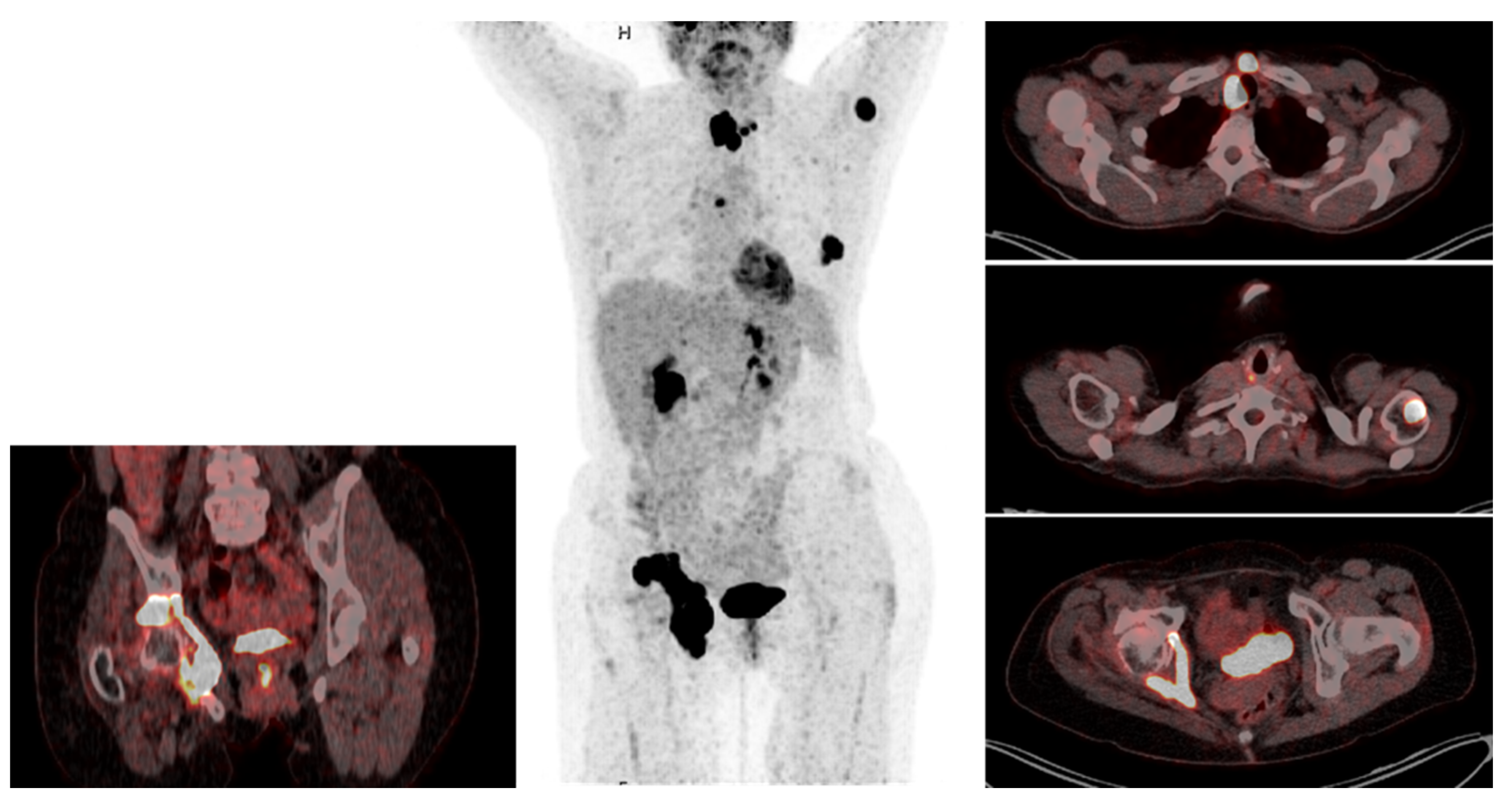 Cancers 13 06230 g001