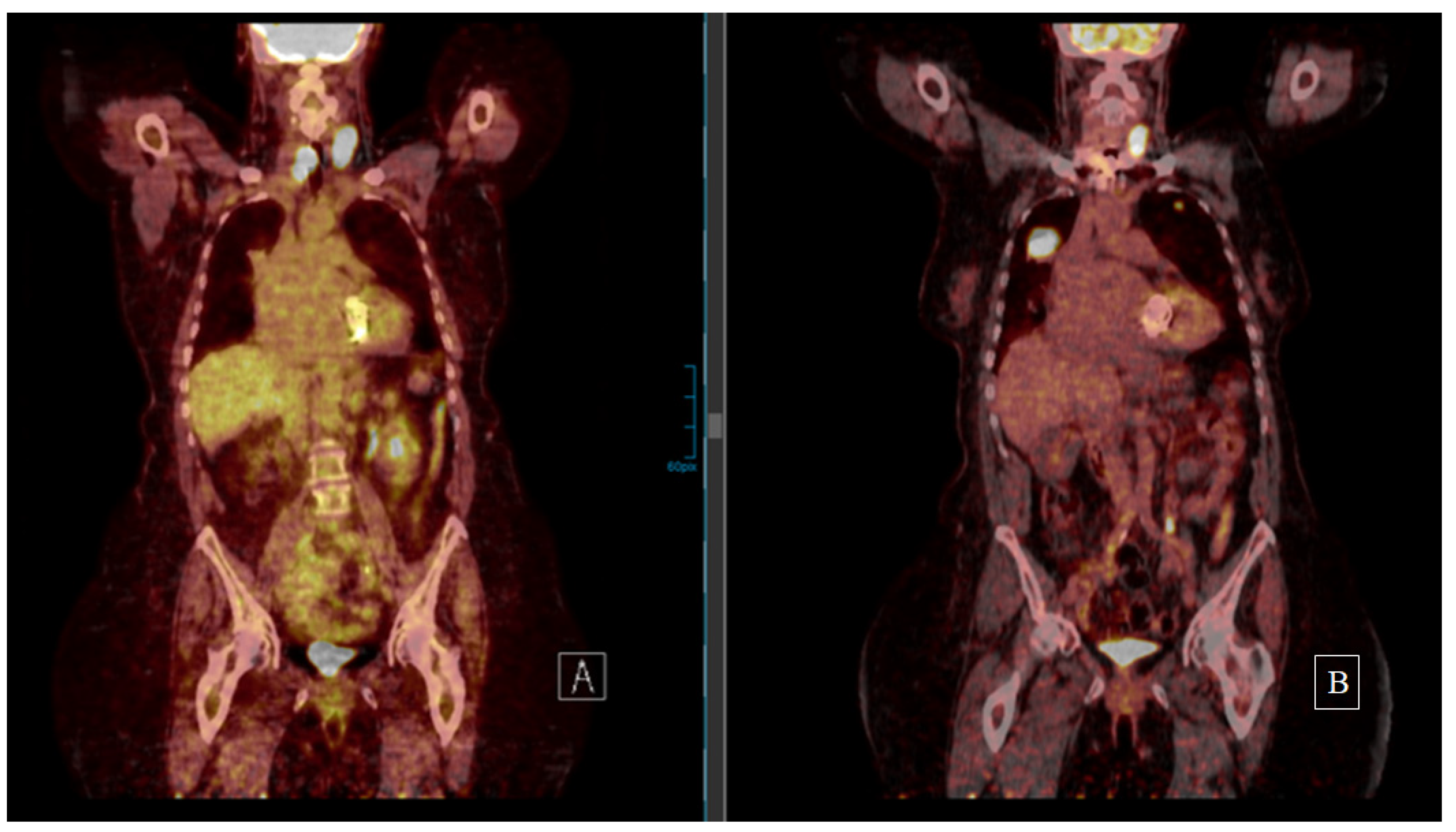 Cancers 13 06230 g002