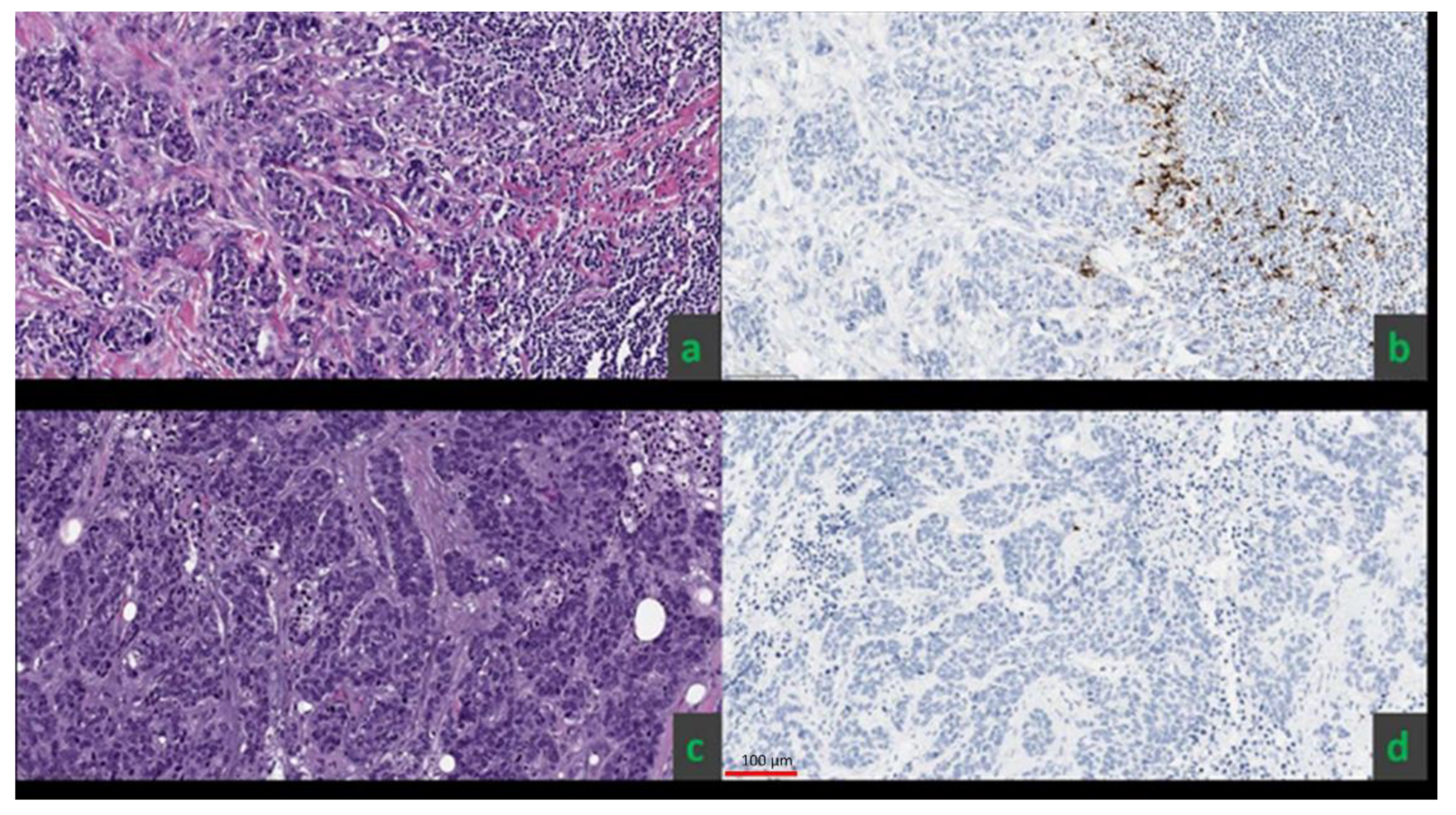 Cancers 13 06273 g001