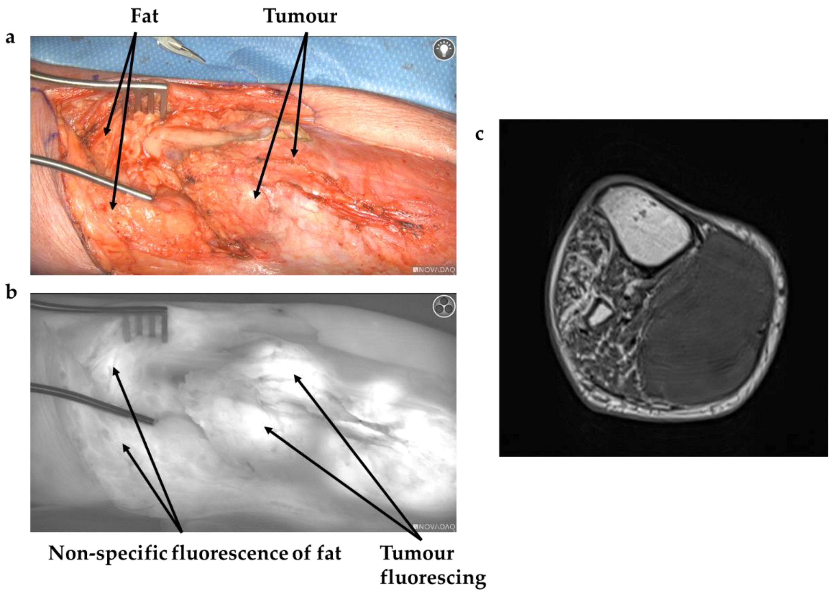 Cancers 13 06284 g001