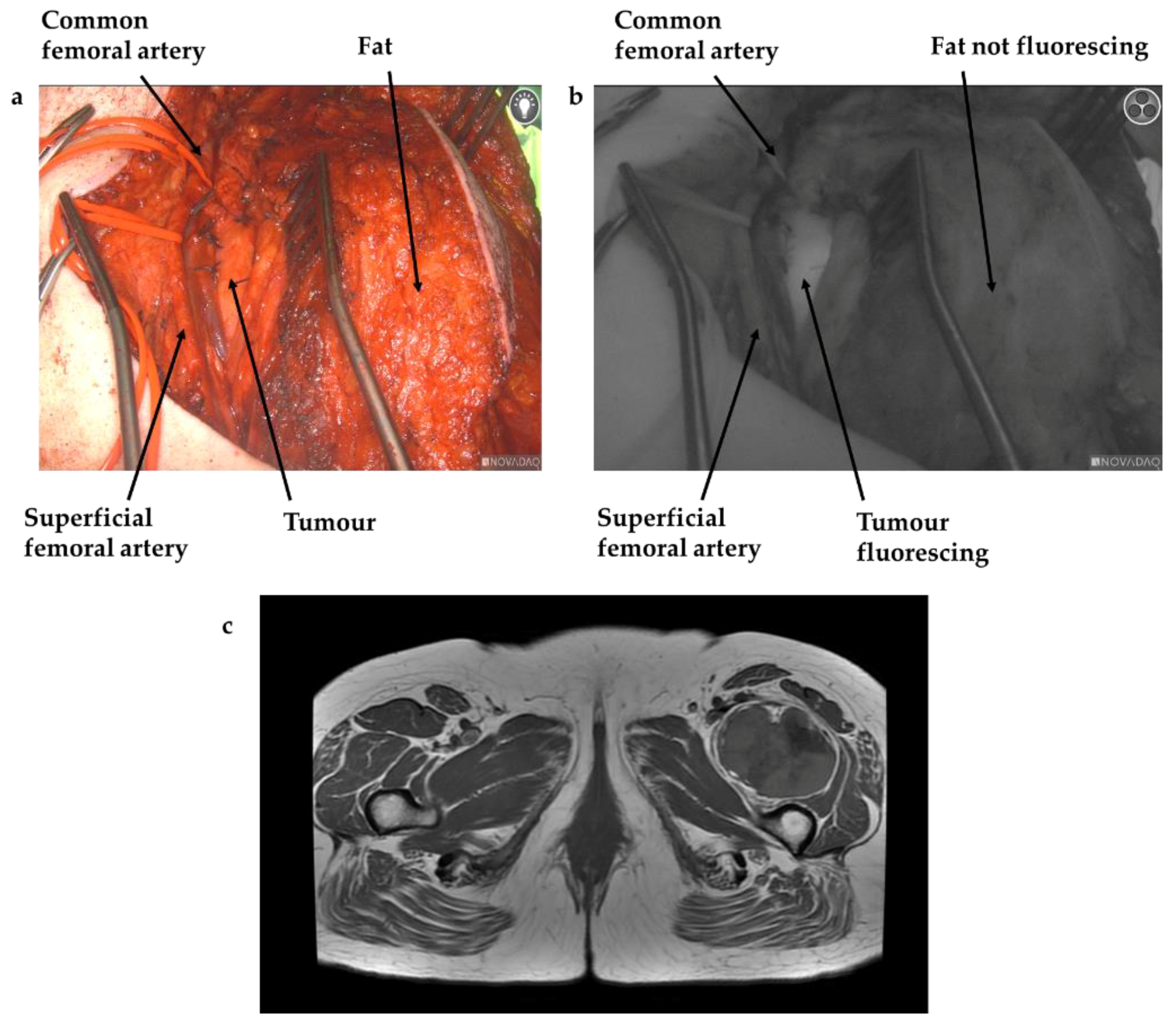 Cancers 13 06284 g002