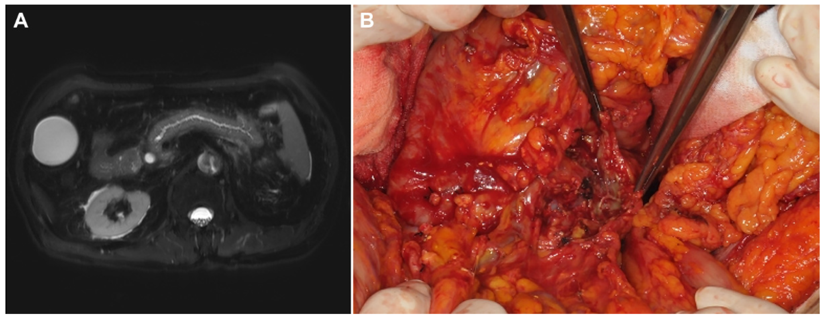 Cancers 13 06289 g001