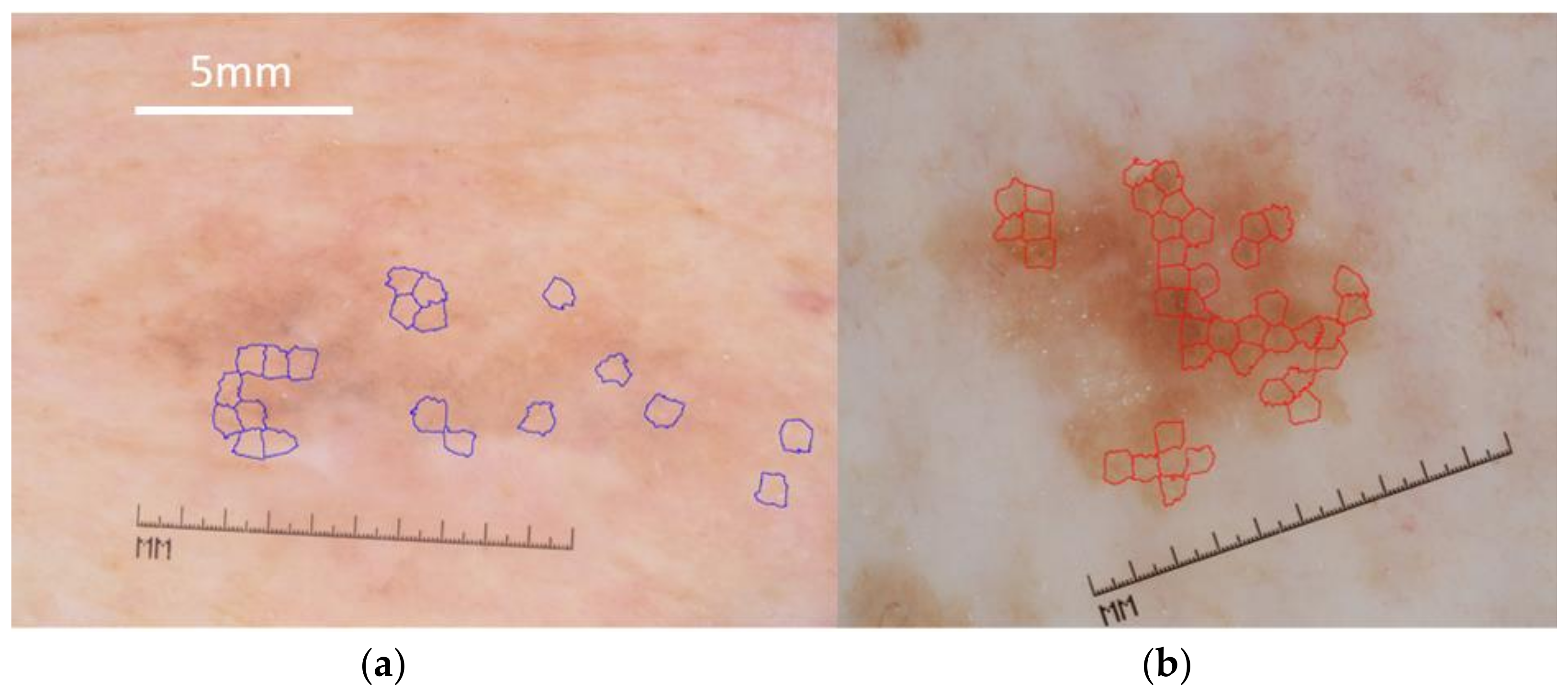 Cancers 13 06300 g001