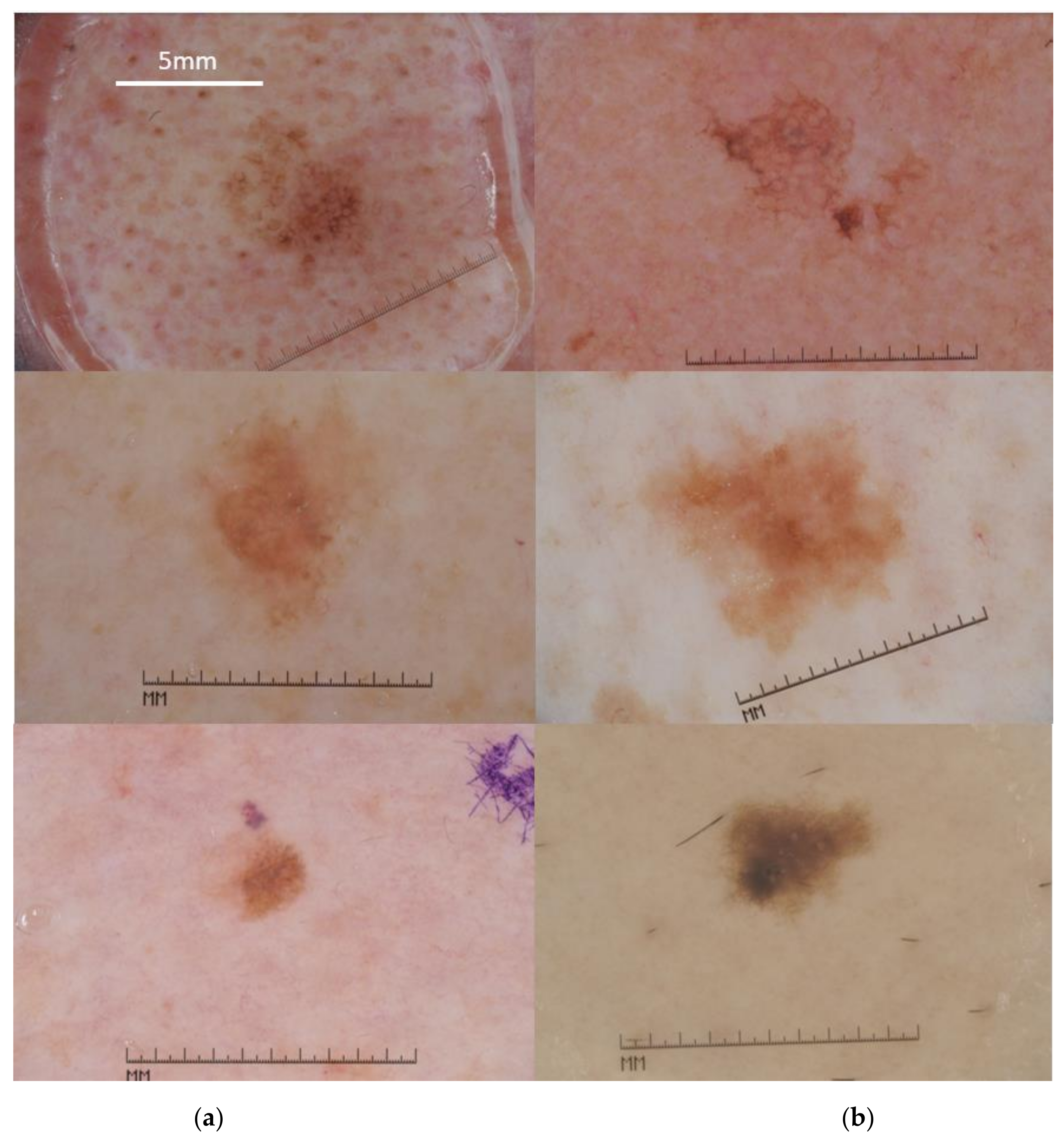 Cancers 13 06300 g002