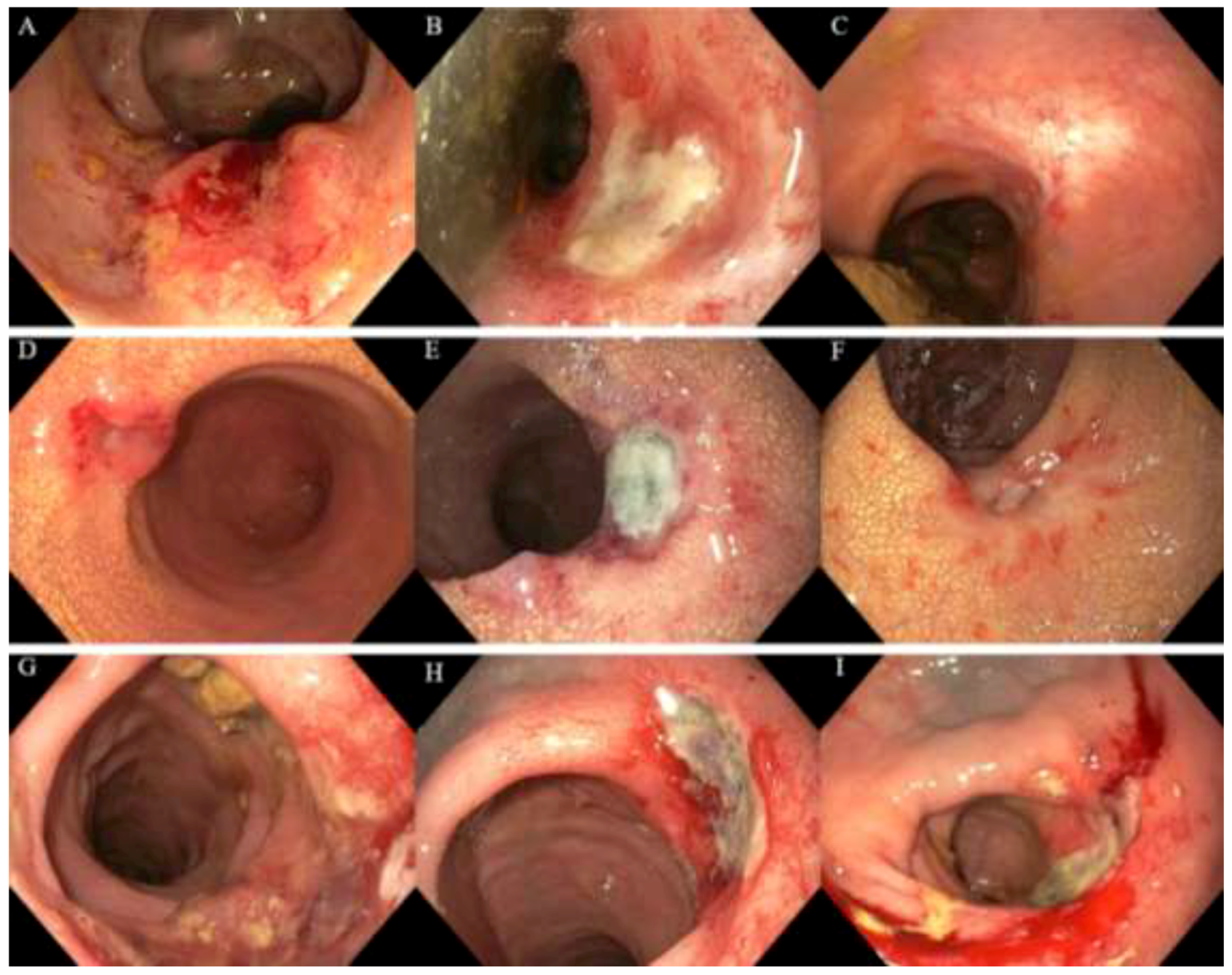 Cancers 13 06333 g002