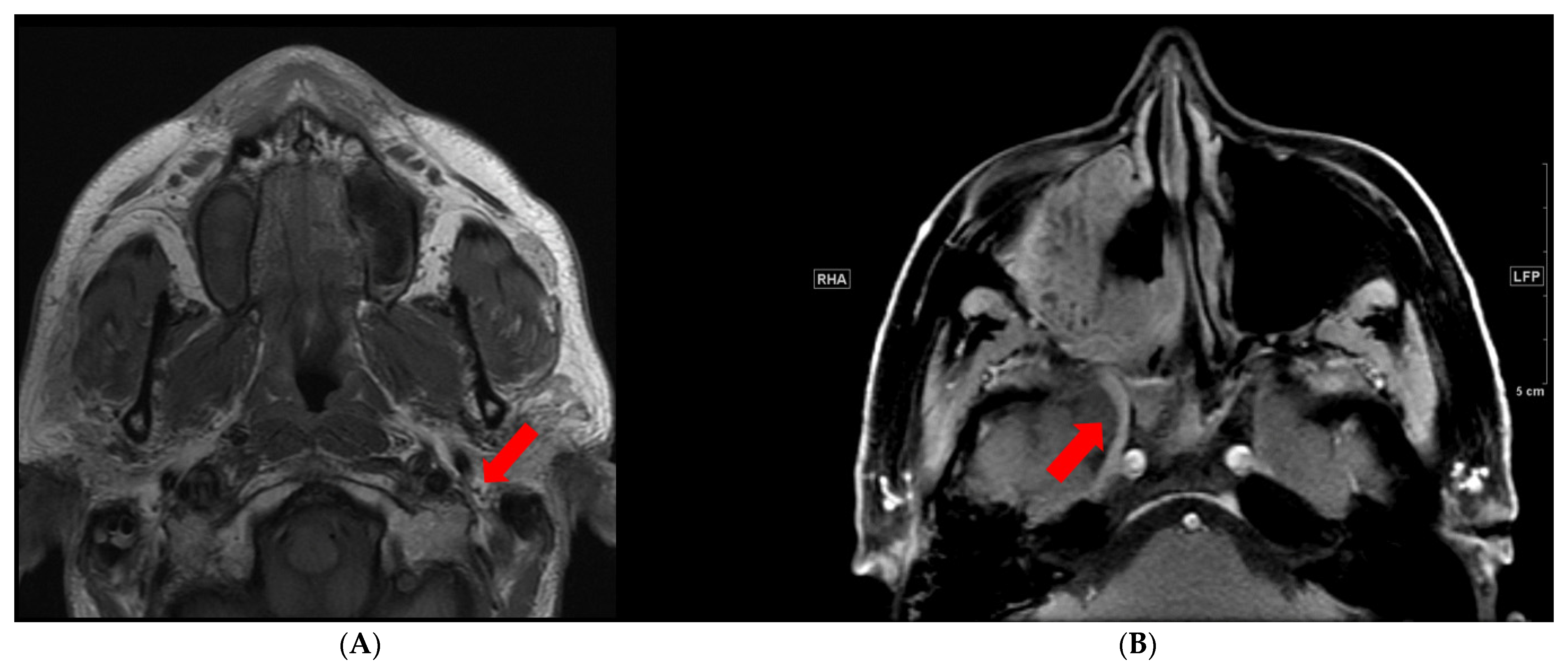 Cancers 13 06335 g001