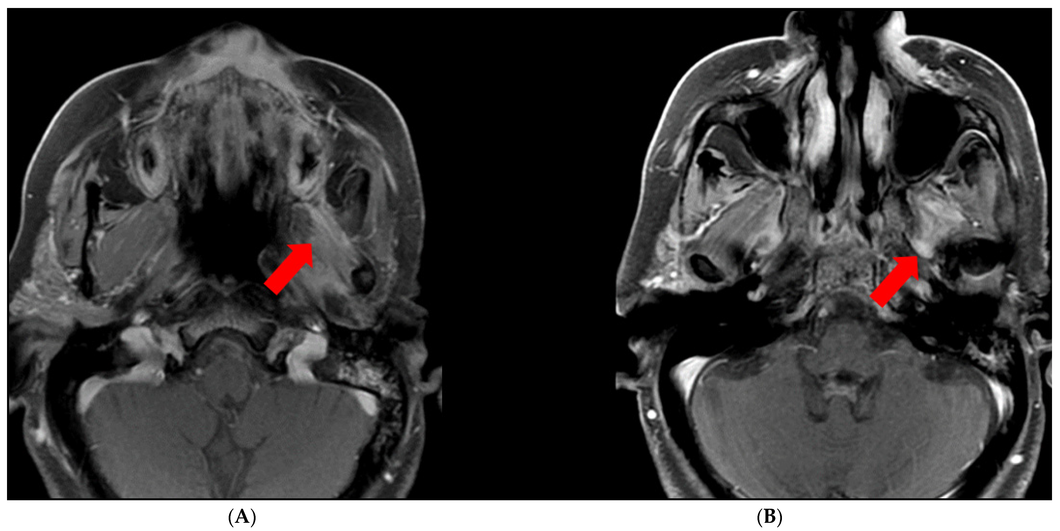 Cancers 13 06335 g002