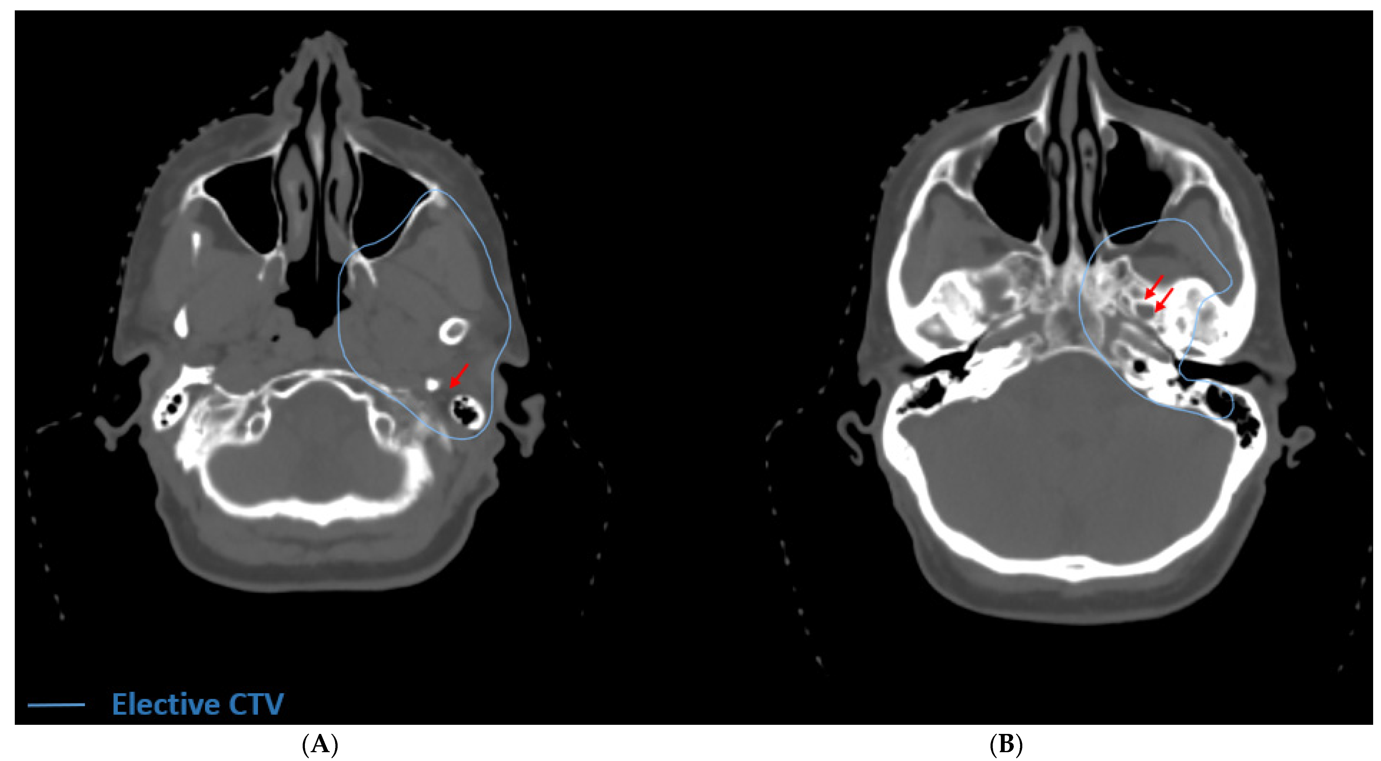 Cancers 13 06335 g003