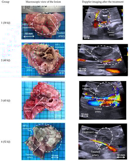 Cancers 13 06381 g004
