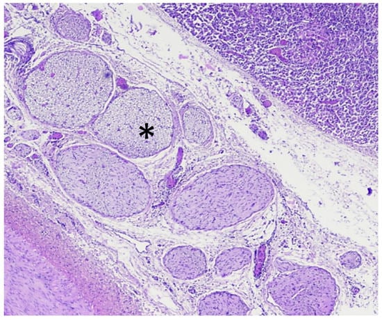 Cancers 13 06381 g007