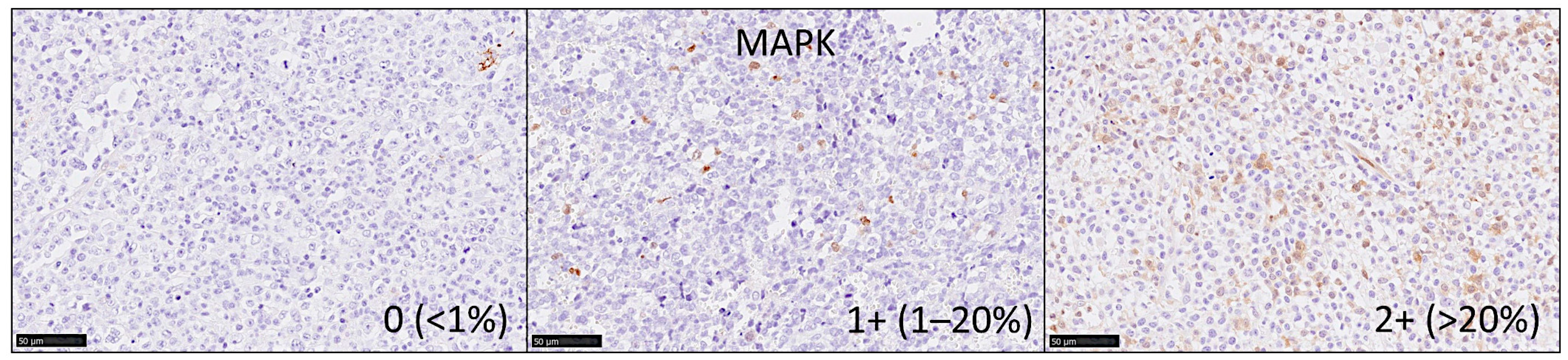 Cancers 13 06384 g006