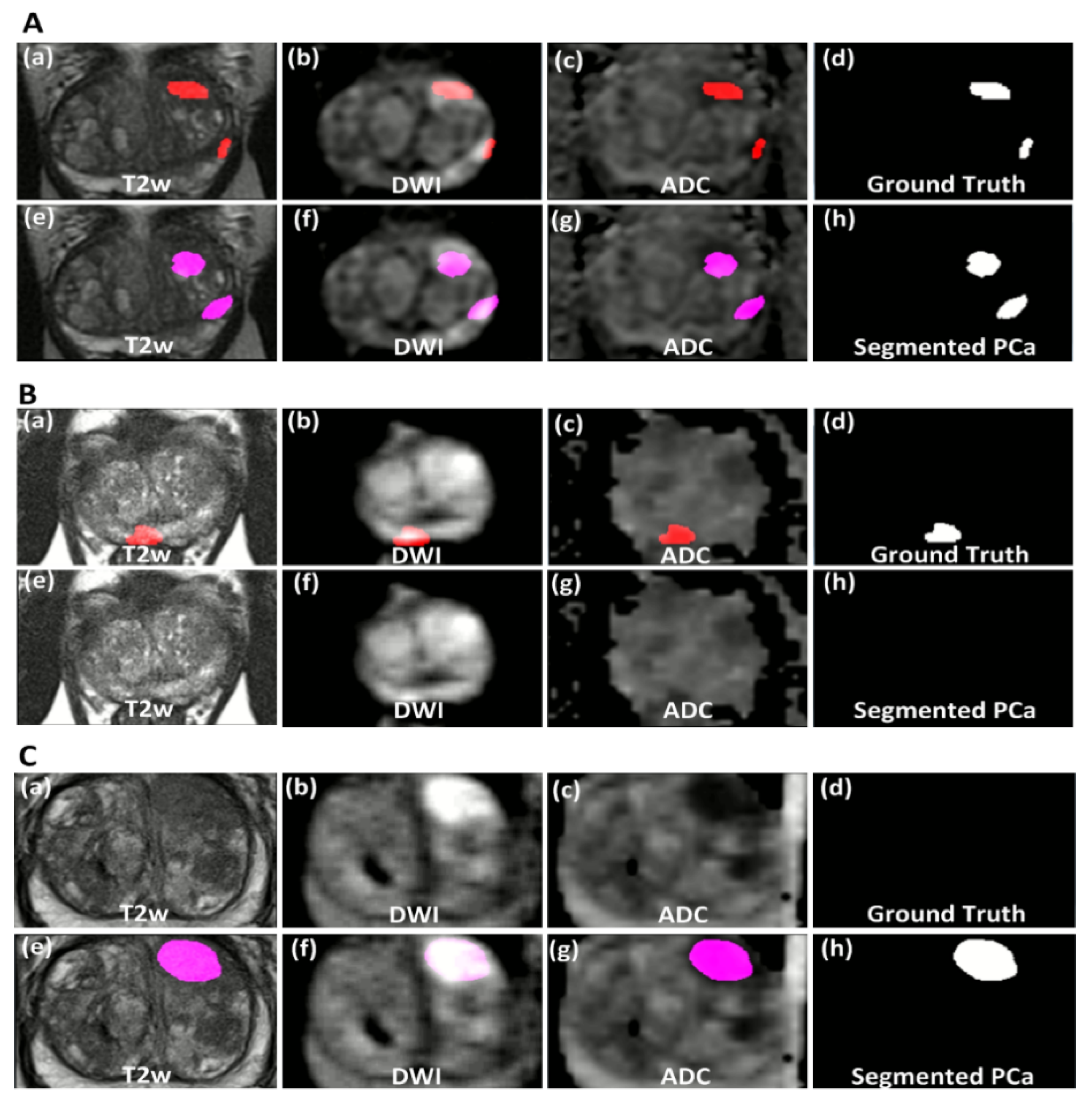 Cancers 14 00012 g004