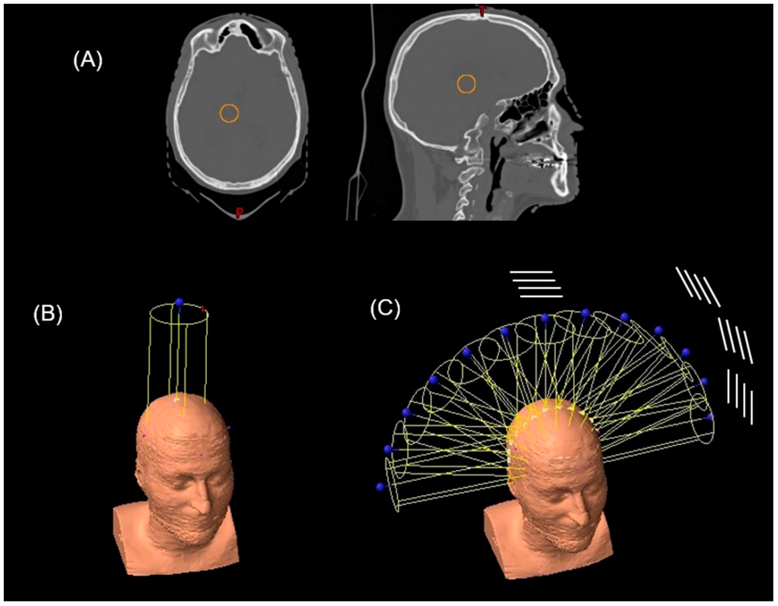 Cancers 14 00116 g001