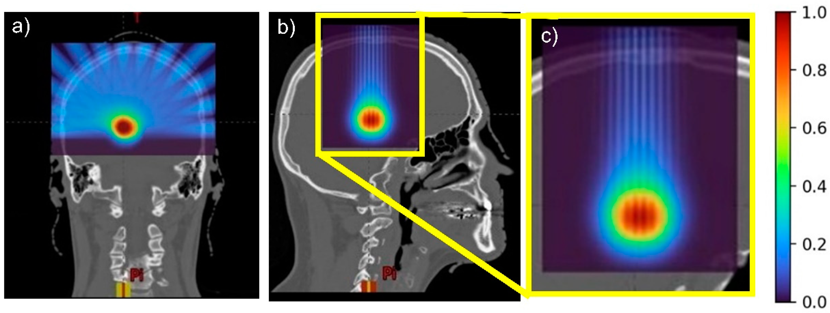 Cancers 14 00116 g002