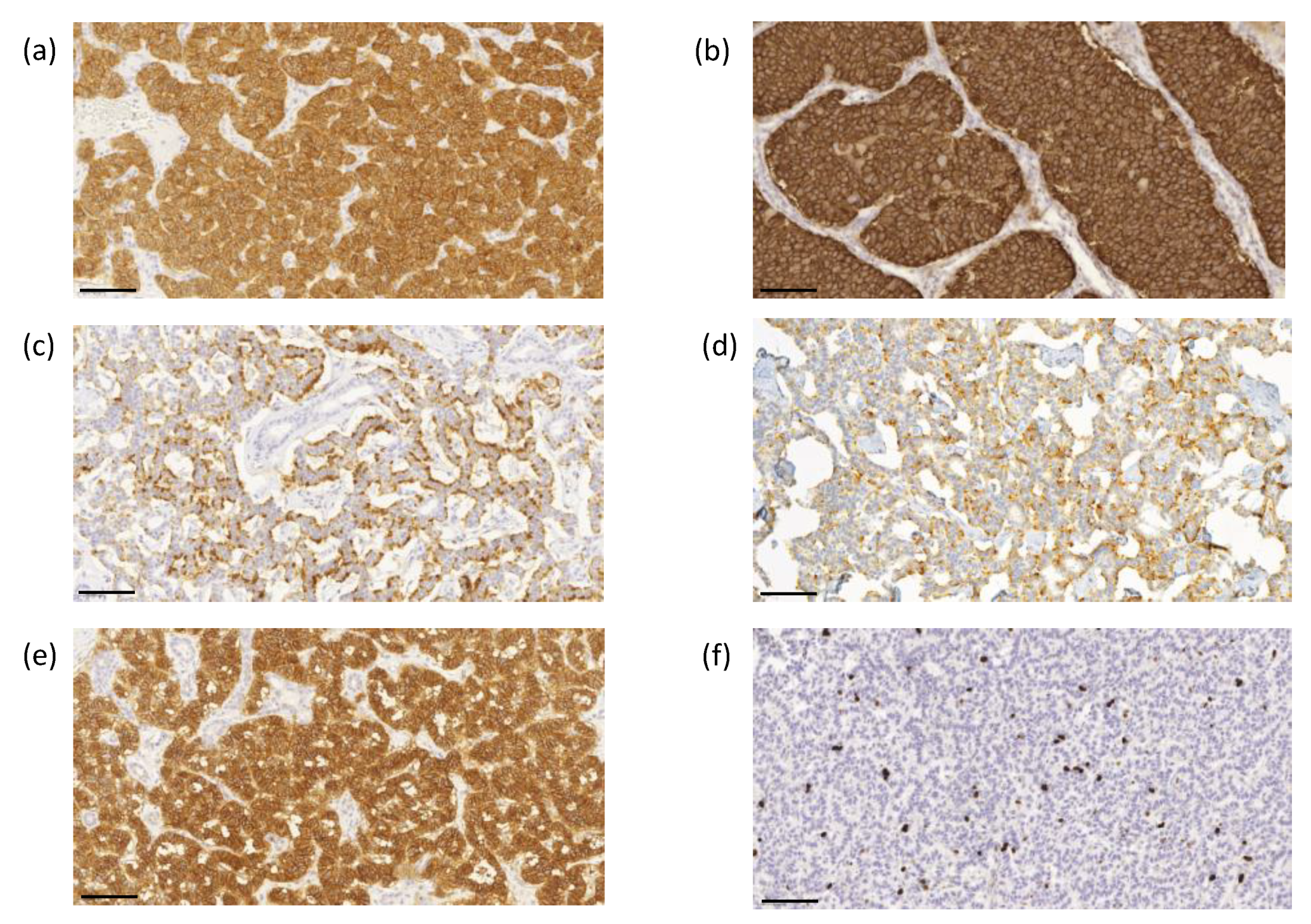 Cancers 14 00162 g003