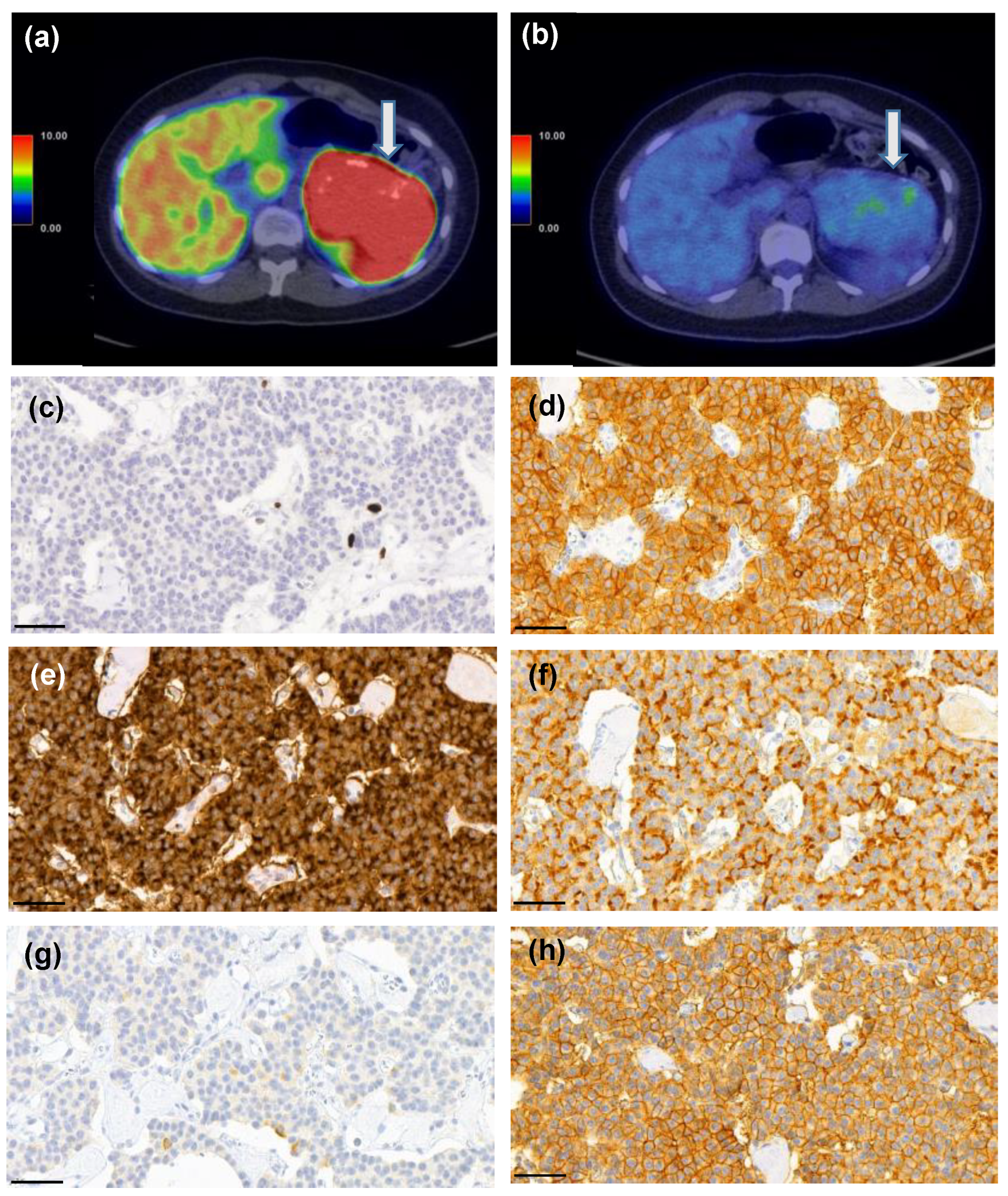 Cancers 14 00162 g007