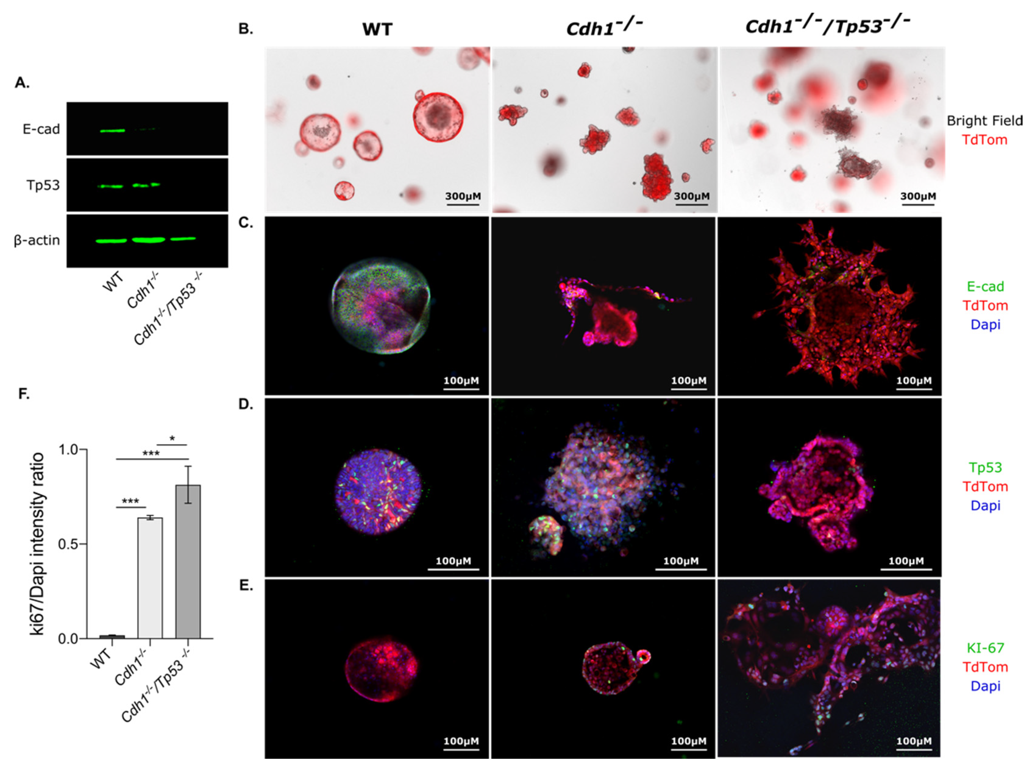 Cancers 14 00175 g004