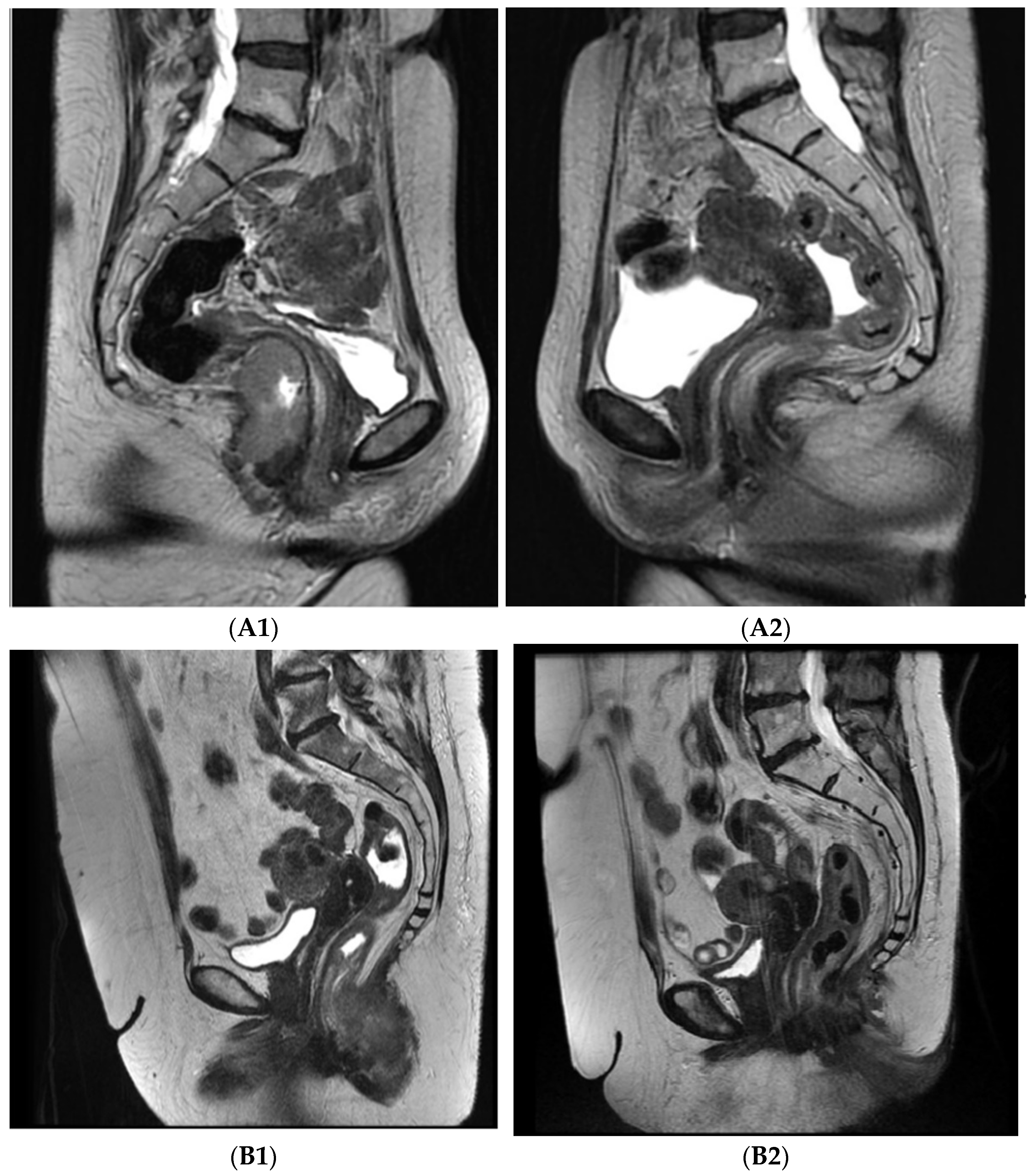 Cancers 14 00185 g001