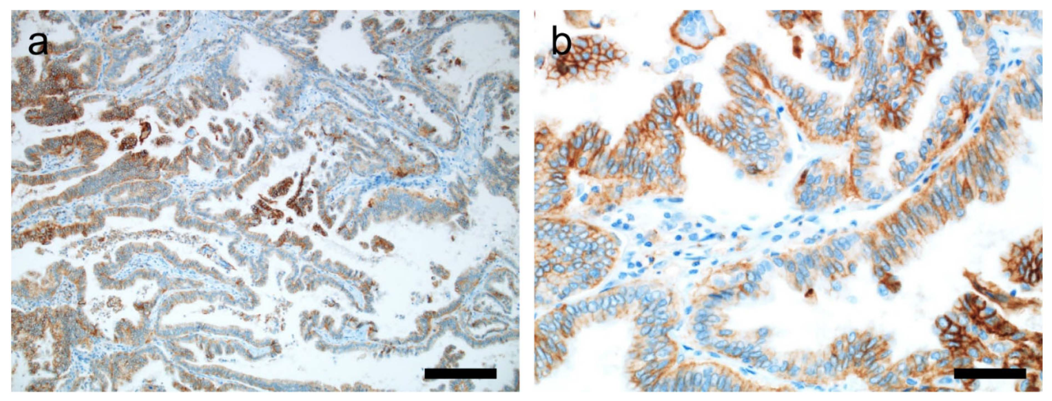 Cancers 14 00204 g006