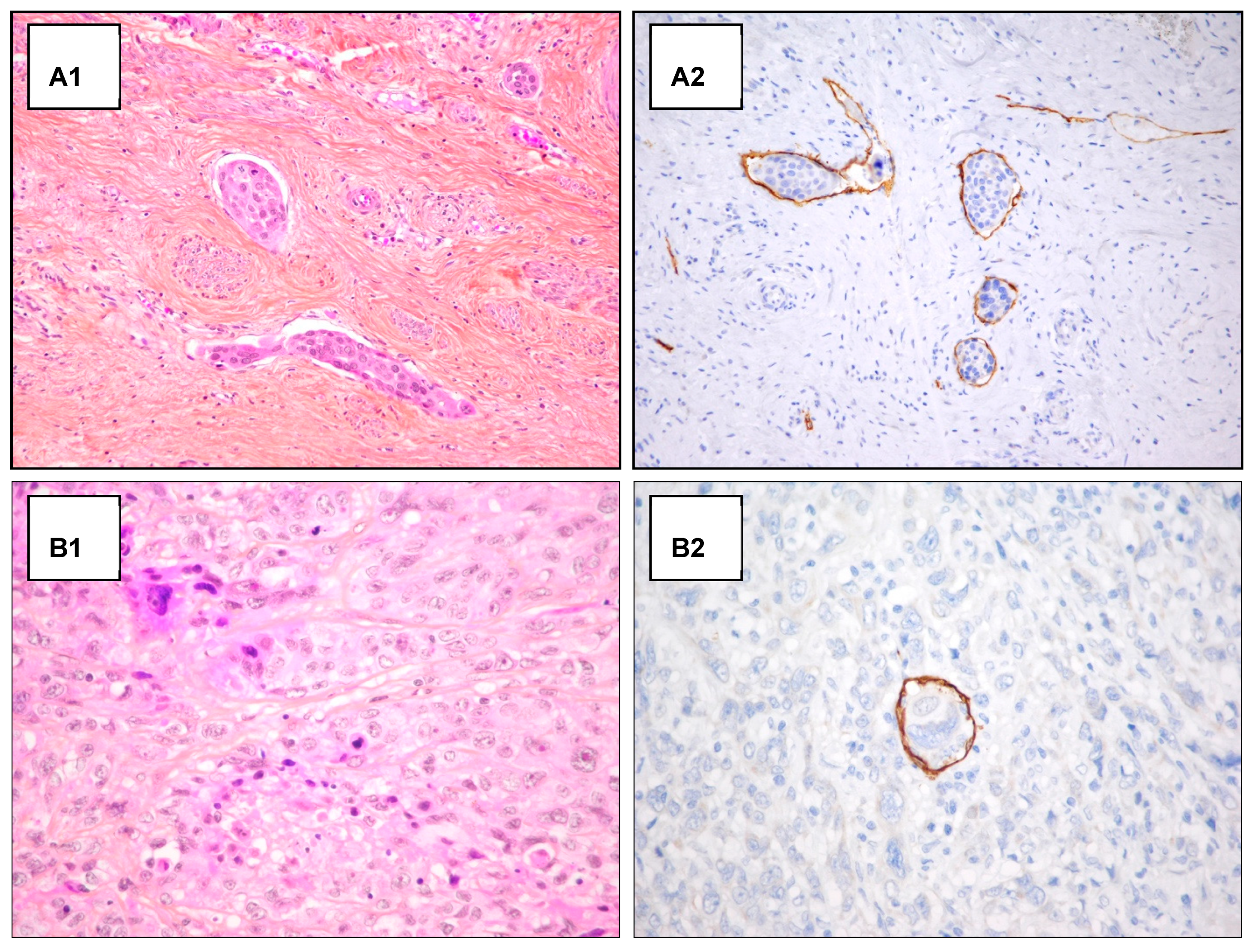 Cancers 14 00212 g0a1