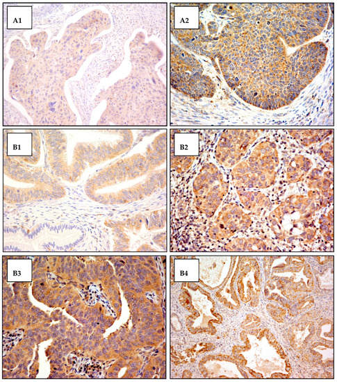 Cancers 14 00212 g0a2