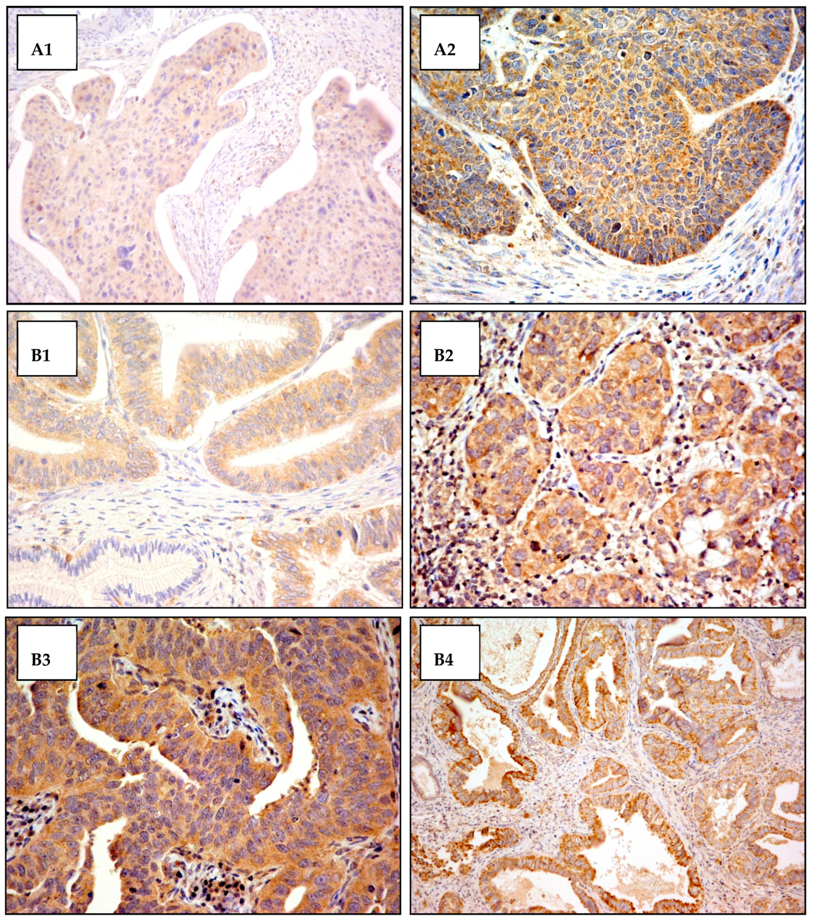 Cancers 14 00212 g0a2