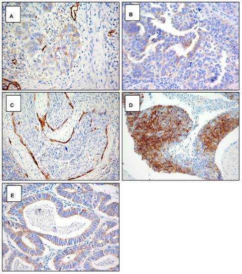 Cancers 14 00212 g0a3