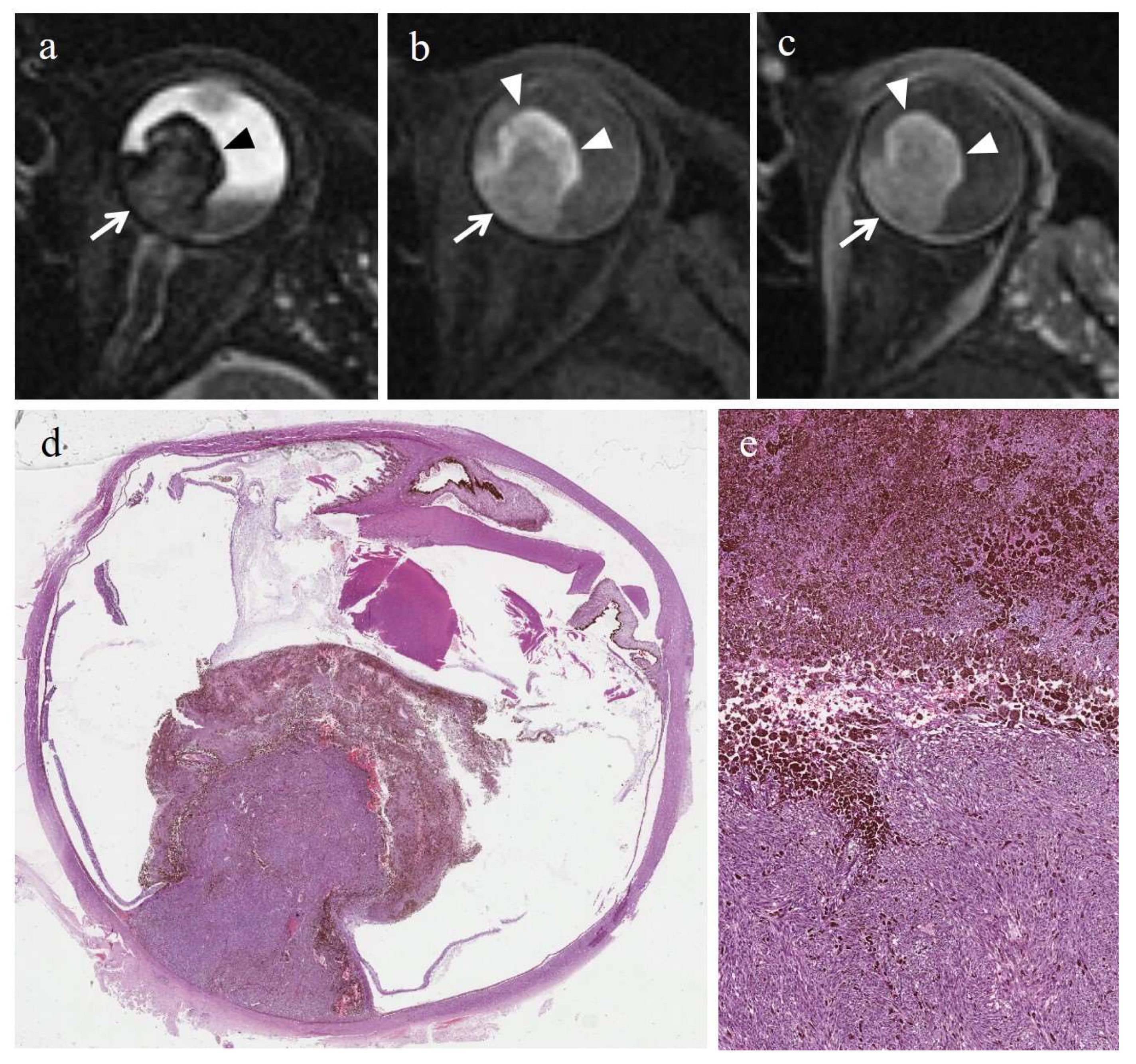 Cancers 14 00215 g004