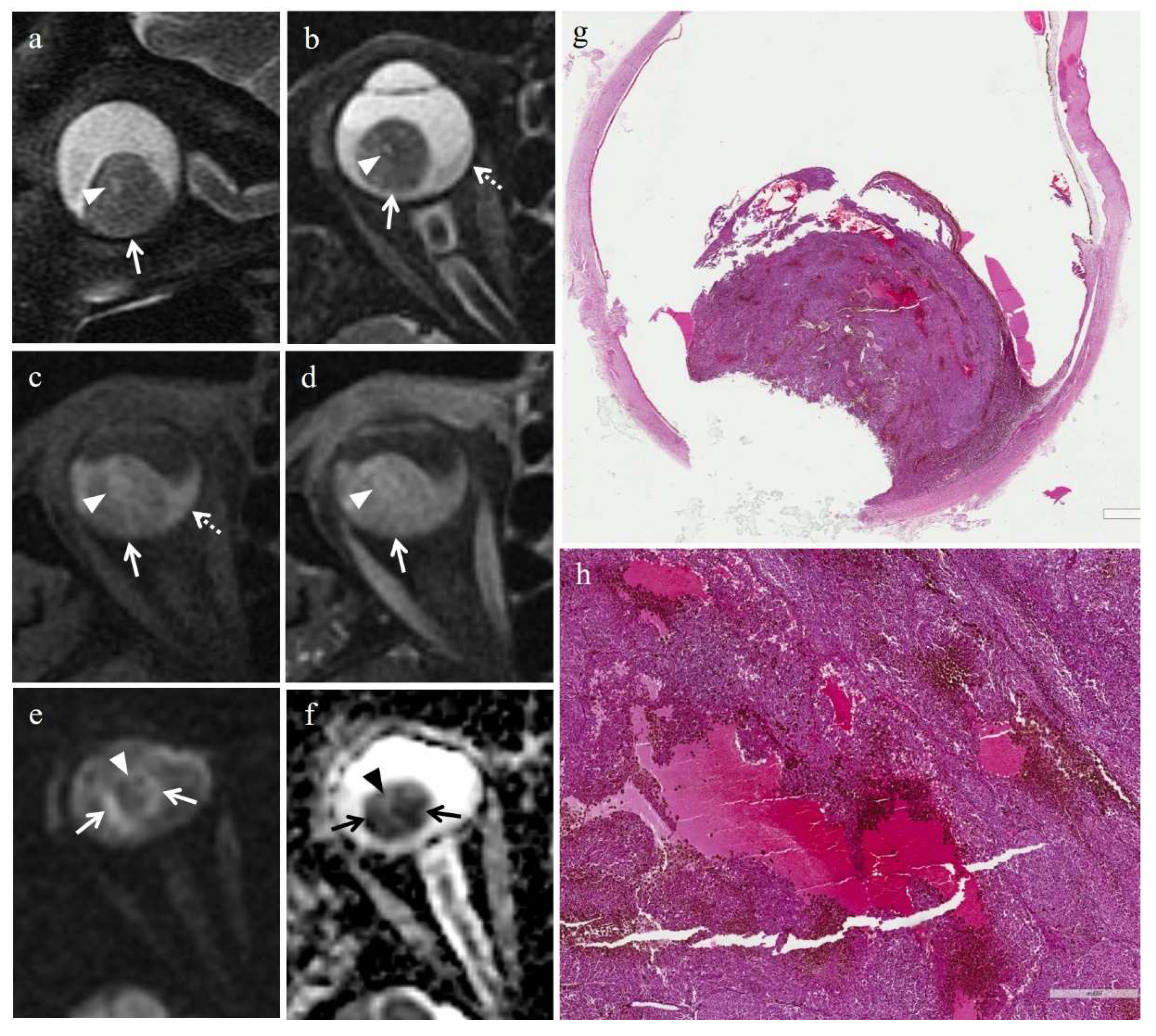 Cancers 14 00215 g005