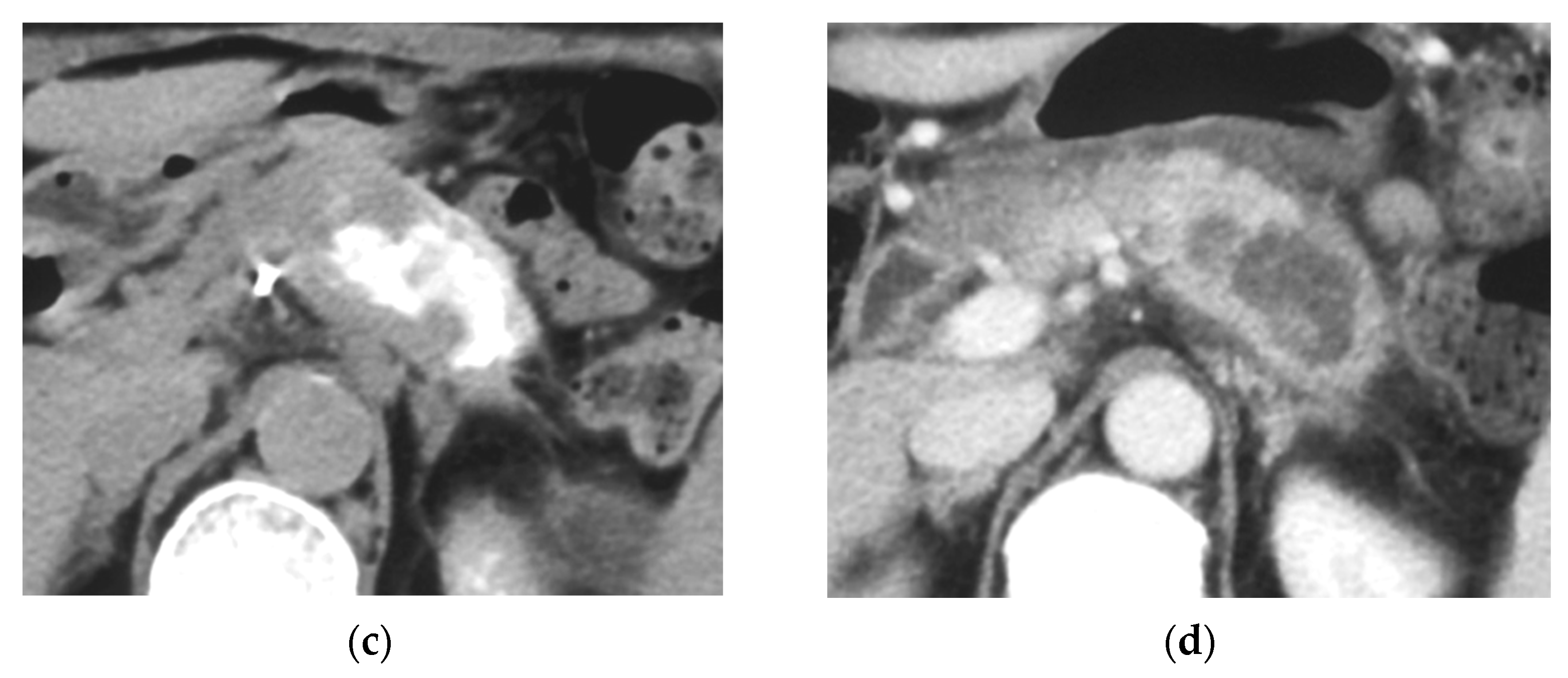 Cancers 14 00220 g001b