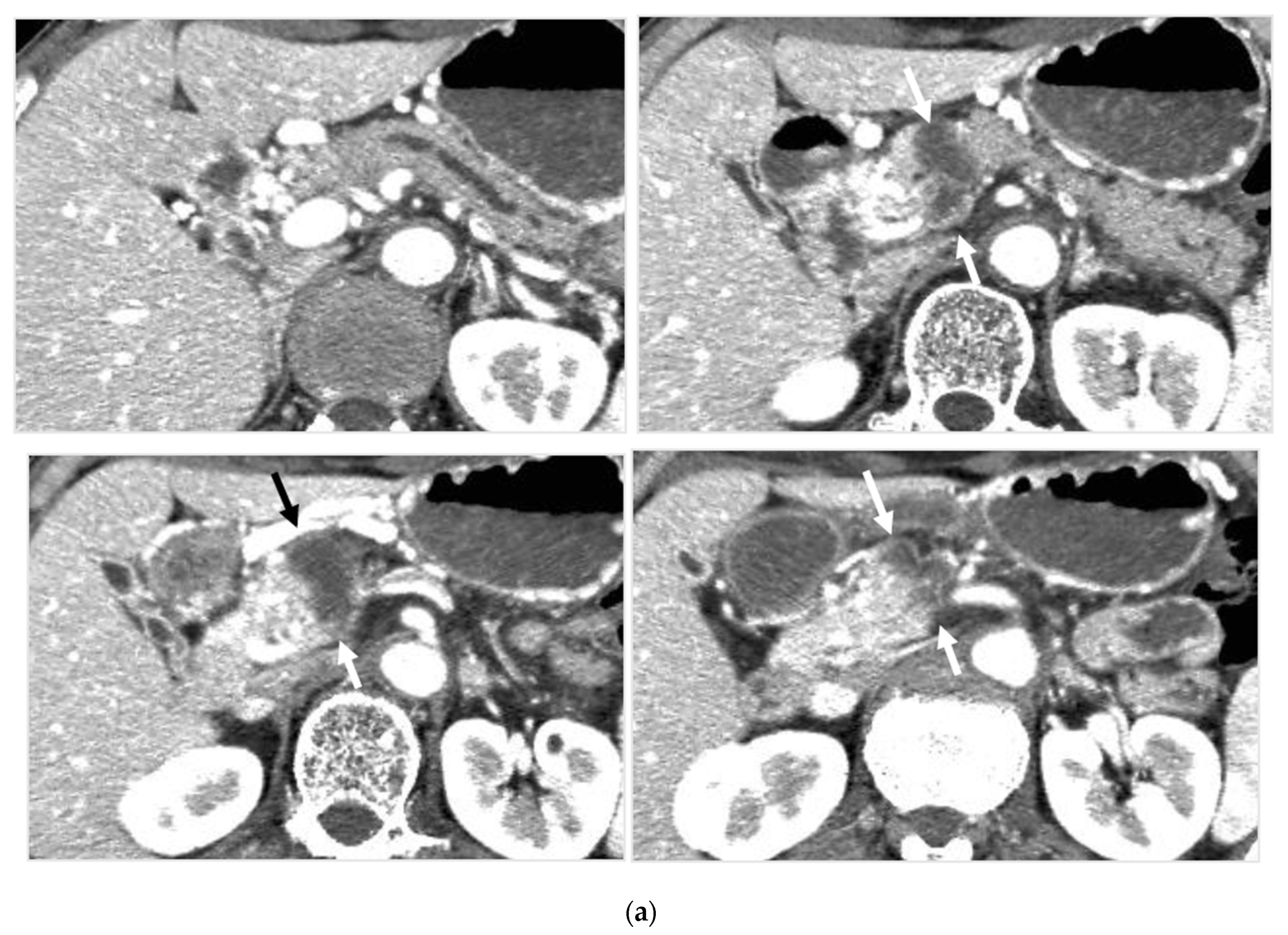 Cancers 14 00220 g004a