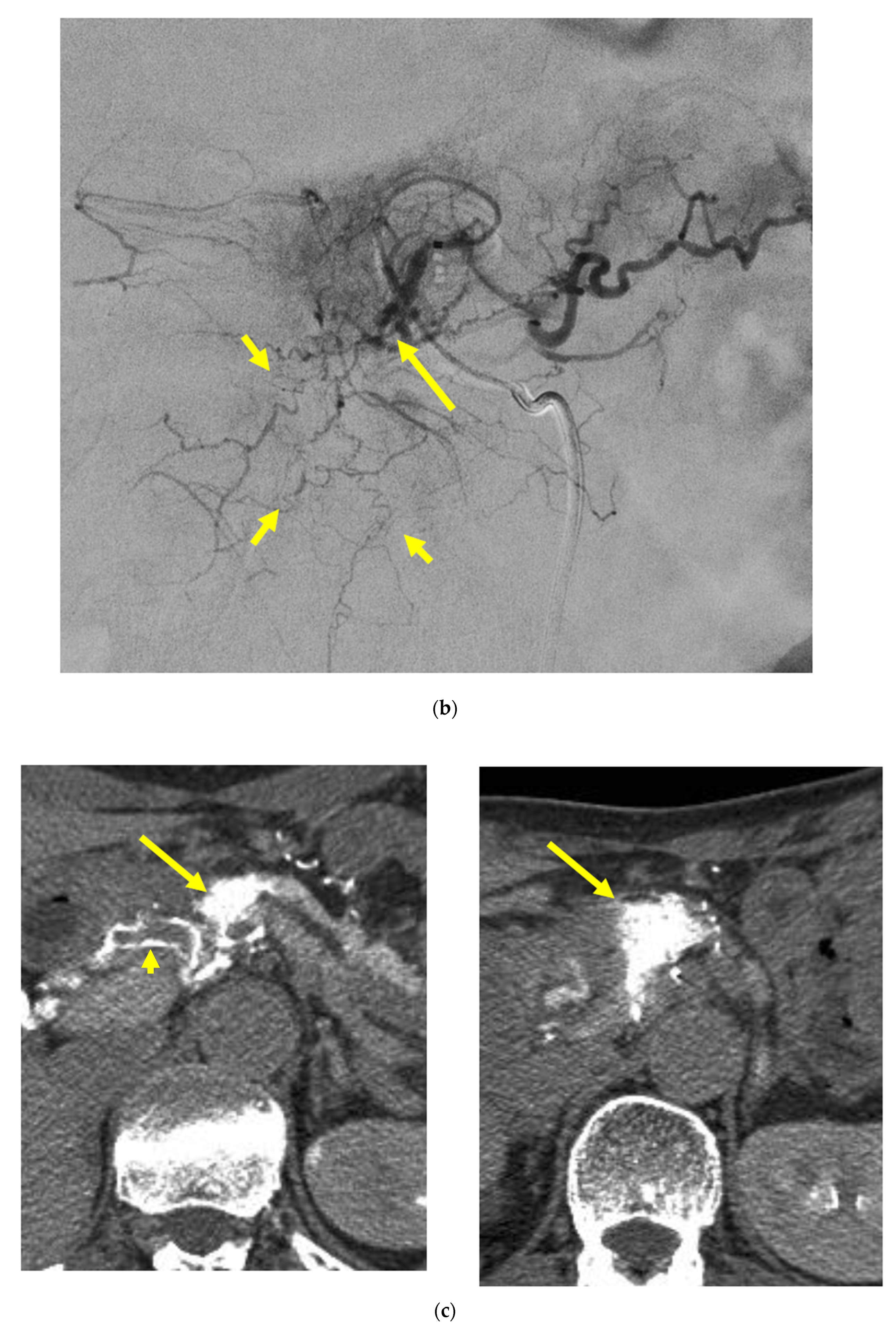Cancers 14 00220 g004b