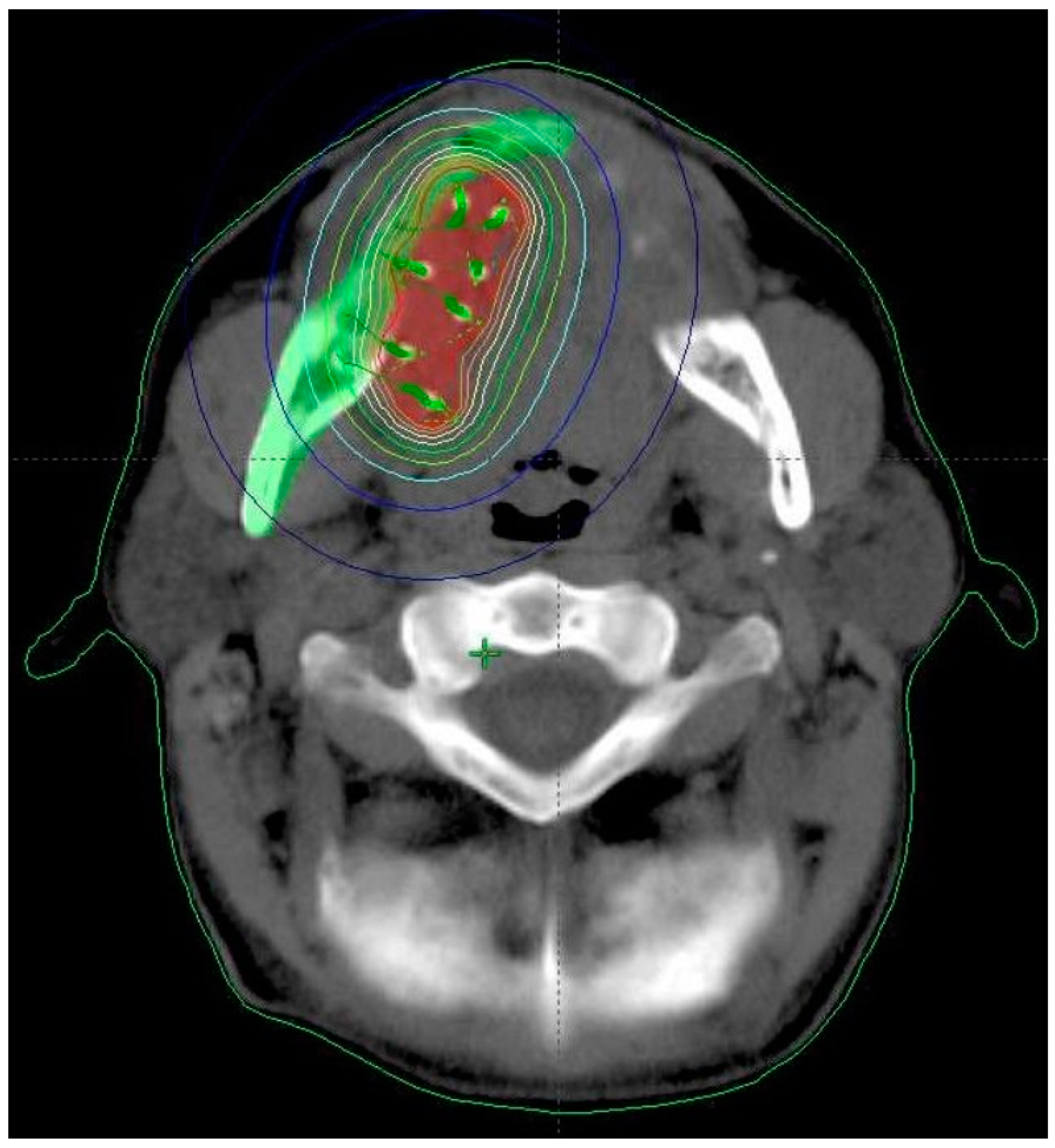 Cancers 14 00222 g001