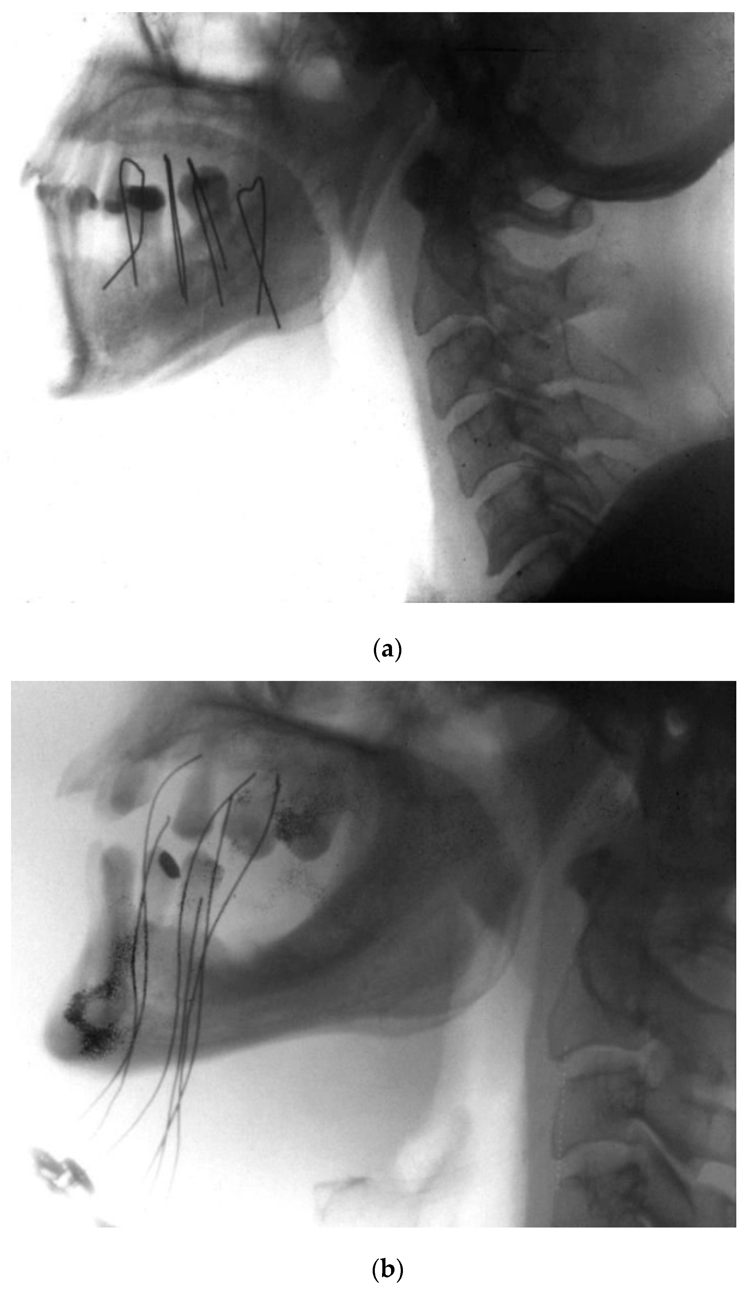 Cancers 14 00222 g003