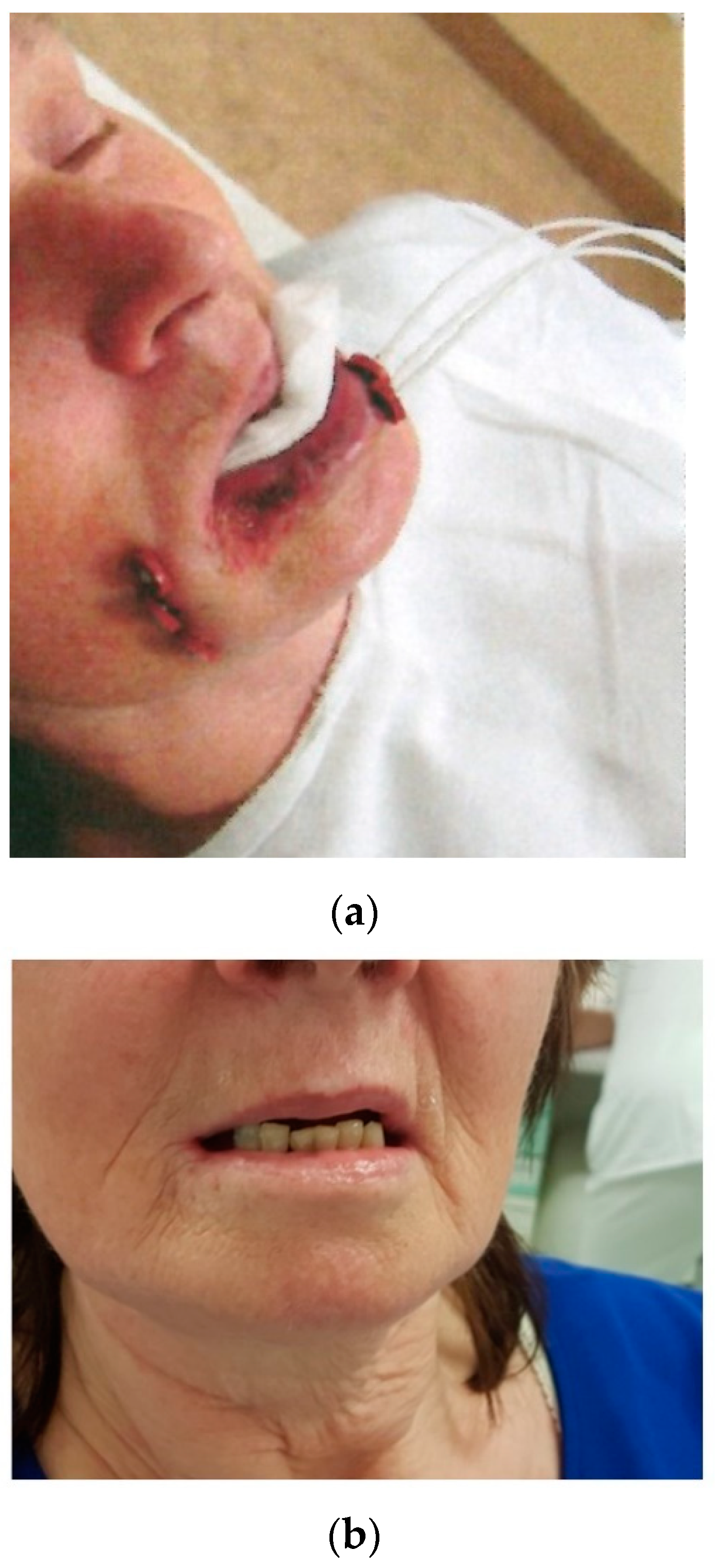 Cancers 14 00222 g004