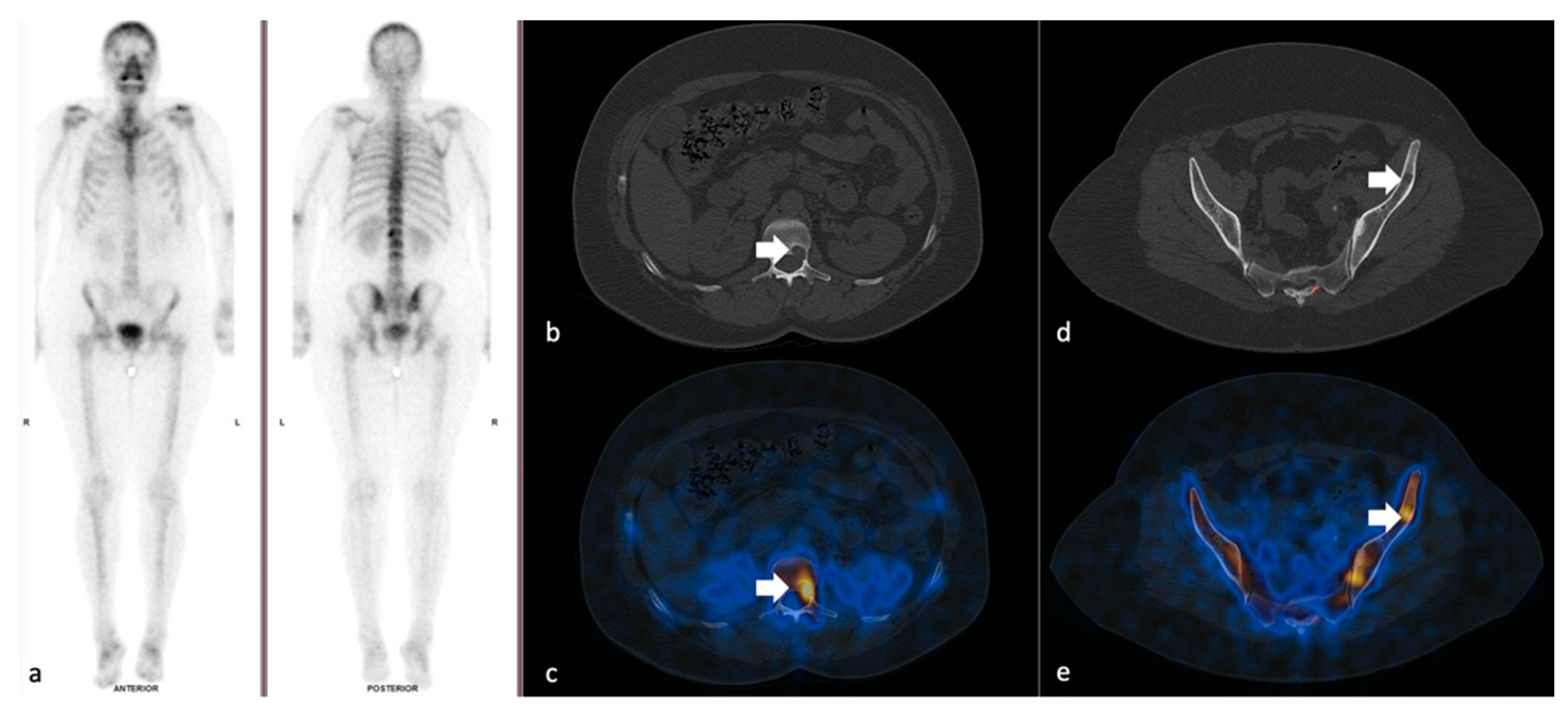 Cancers 14 00273 g001