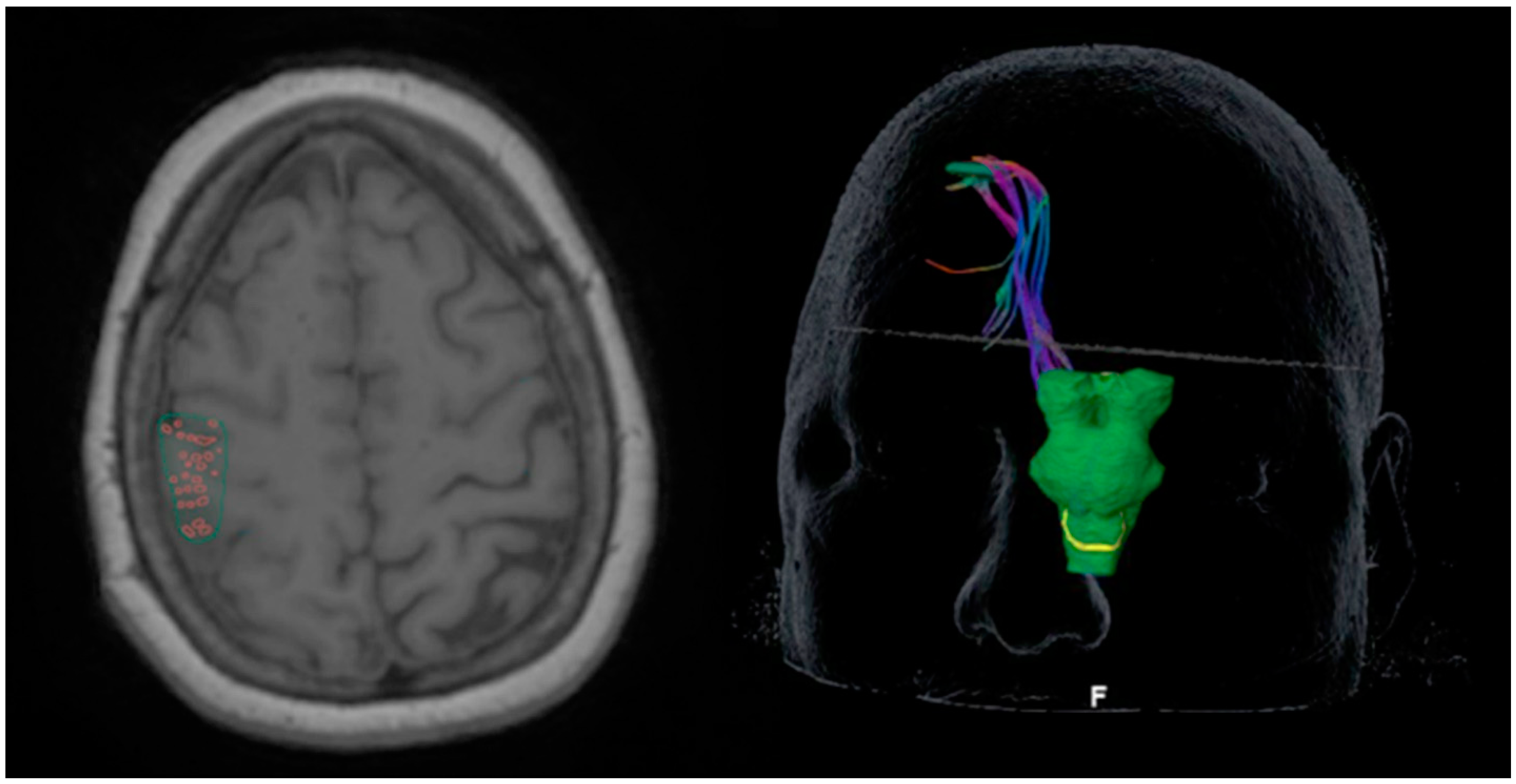 Cancers 14 00340 g001