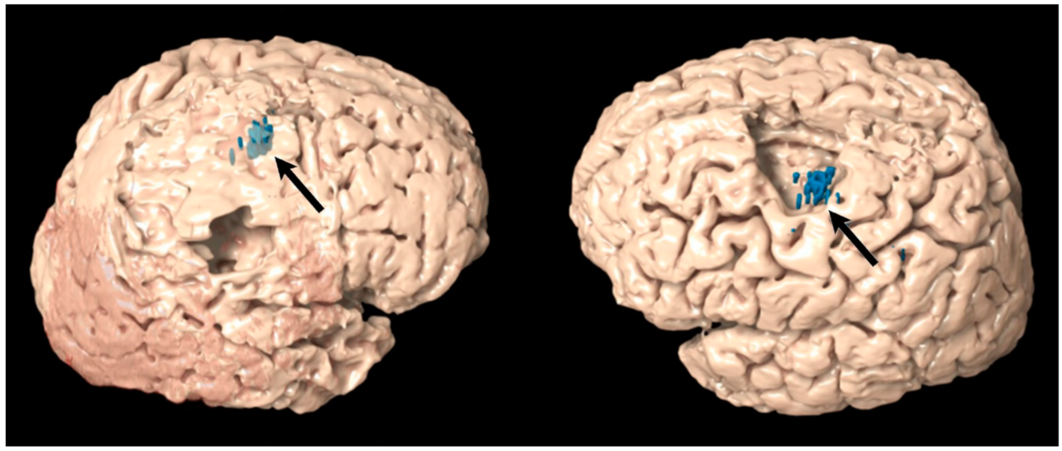 Cancers 14 00340 g002