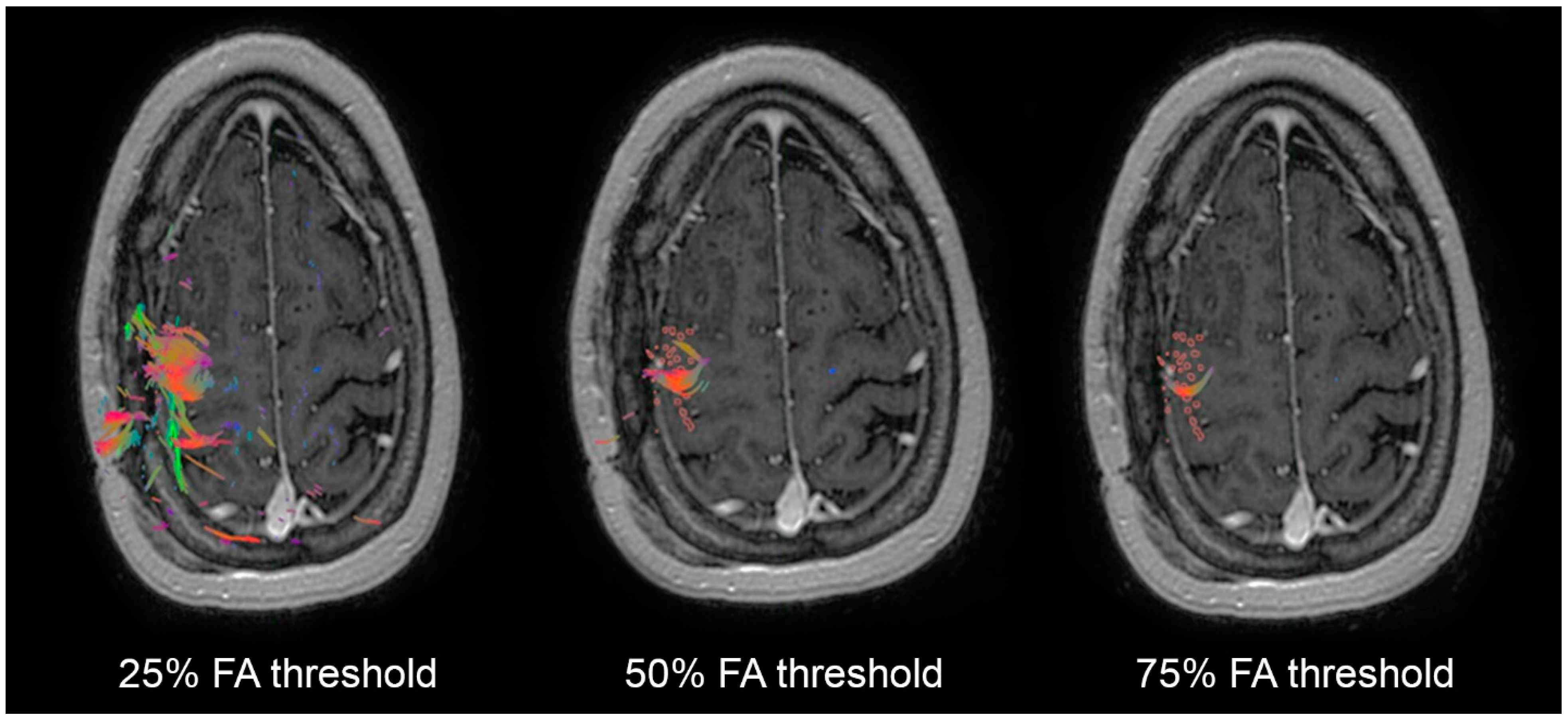 Cancers 14 00340 g003